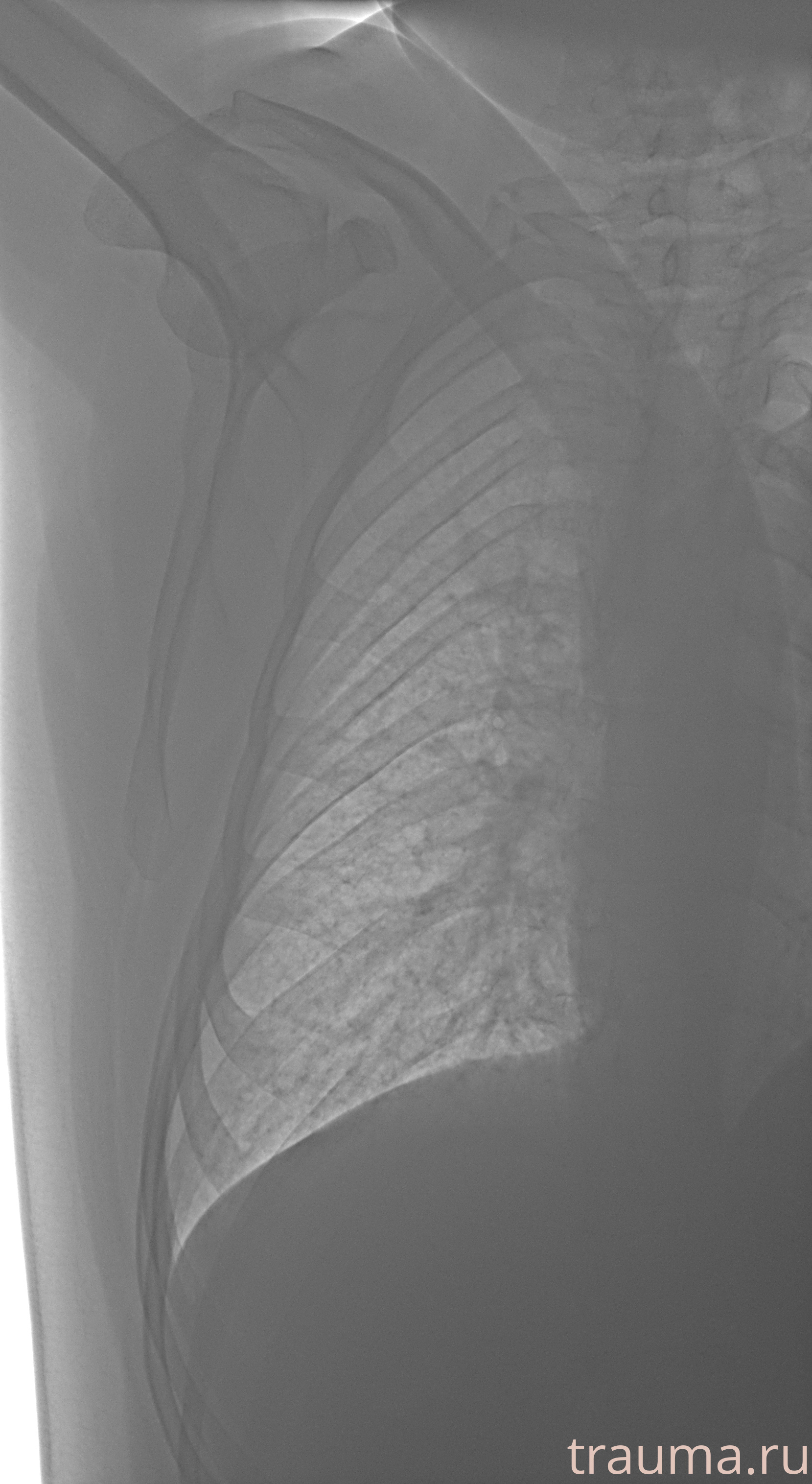 Рентген на дому: по вашему адресу приезжает врач-рентгенолог, травматолог-ортопед с мобильным рентгеновским аппаратом, проводит диагностику травмы или заболевания, делает необходимые рентгенограммы, дает рекомендации по дальнейшему лечению. Получить качественные снимки в домашних условиях возможно благодаря уникальной методике, разработанной МосРентген Центром для института  Склифосовского