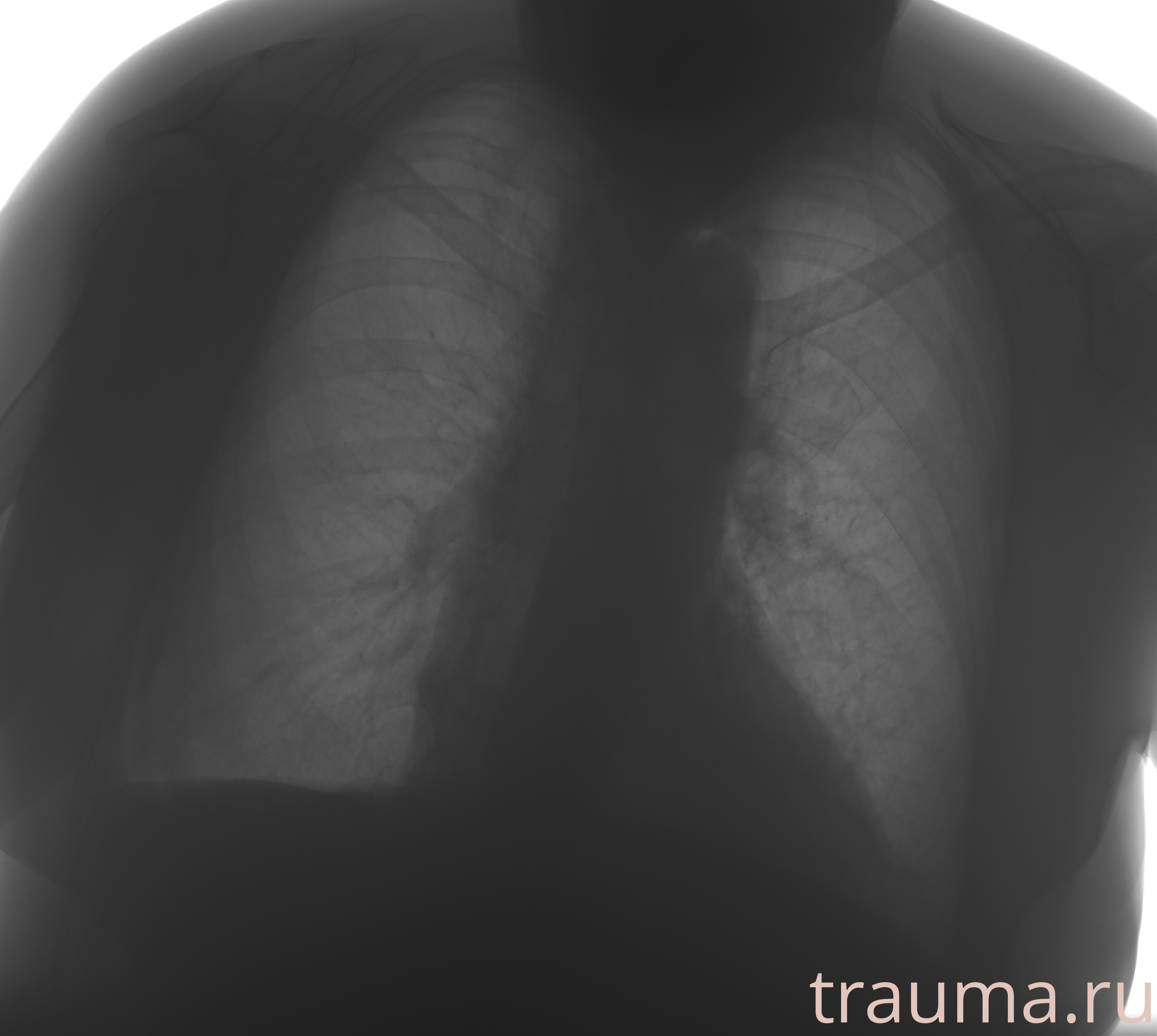 Рентген на дому: по вашему адресу приезжает врач-рентгенолог, травматолог-ортопед с мобильным рентгеновским аппаратом, проводит диагностику травмы или заболевания, делает необходимые рентгенограммы, дает рекомендации по дальнейшему лечению. Получить качественные снимки в домашних условиях возможно благодаря уникальной методике, разработанной МосРентген Центром для института  Склифосовского