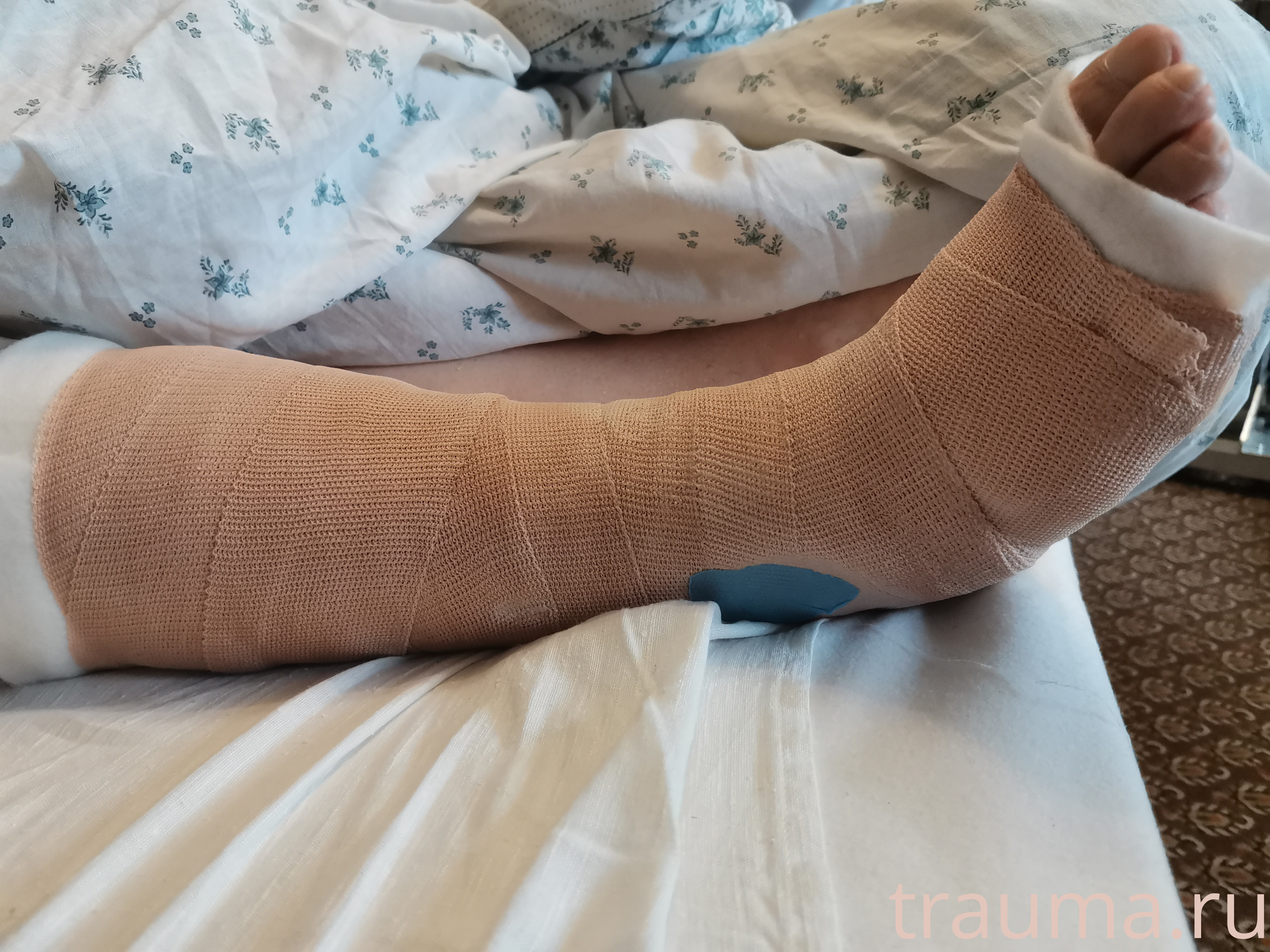 Рентген на дому: по вашему адресу приезжает врач-рентгенолог, травматолог-ортопед с мобильным рентгеновским аппаратом, проводит диагностику травмы или заболевания, делает необходимые рентгенограммы, дает рекомендации по дальнейшему лечению. Получить качественные снимки в домашних условиях возможно благодаря уникальной методике, разработанной МосРентген Центром для института  Склифосовского