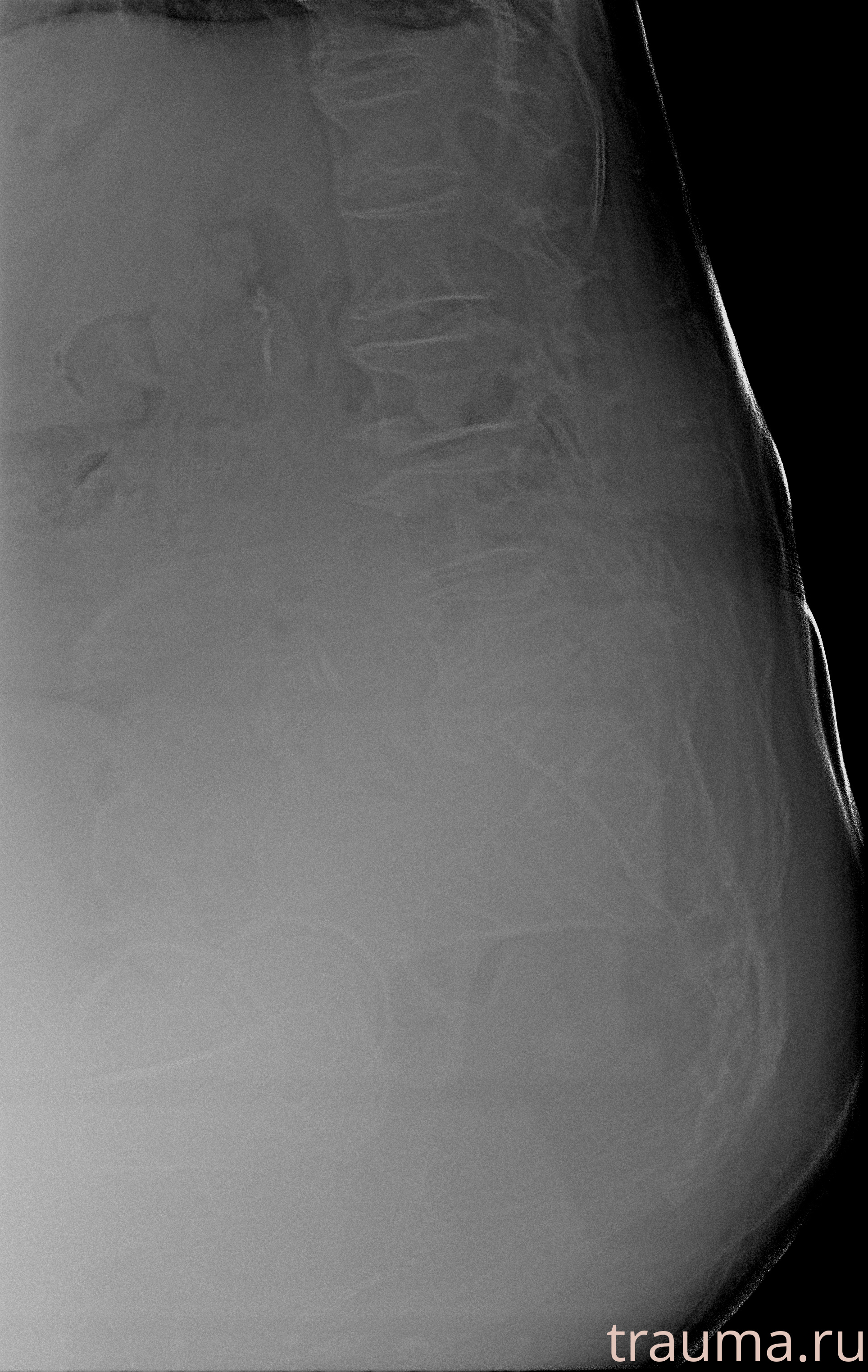 Рентген на дому: по вашему адресу приезжает врач-рентгенолог, травматолог-ортопед с мобильным рентгеновским аппаратом, проводит диагностику травмы или заболевания, делает необходимые рентгенограммы, дает рекомендации по дальнейшему лечению. Получить качественные снимки в домашних условиях возможно благодаря уникальной методике, разработанной МосРентген Центром для института  Склифосовского