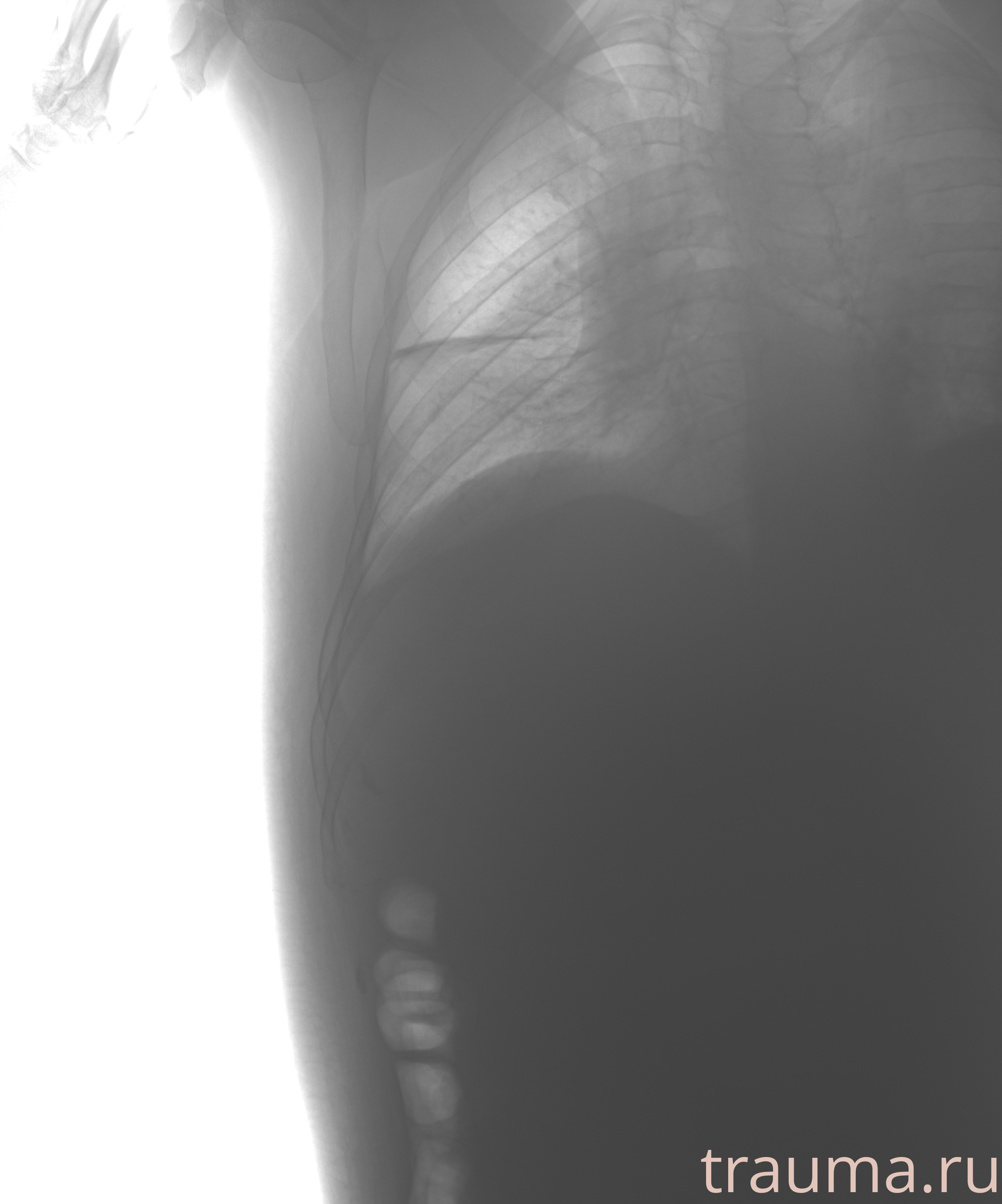 Рентген на дому: по вашему адресу приезжает врач-рентгенолог, травматолог-ортопед с мобильным рентгеновским аппаратом, проводит диагностику травмы или заболевания, делает необходимые рентгенограммы, дает рекомендации по дальнейшему лечению. Получить качественные снимки в домашних условиях возможно благодаря уникальной методике, разработанной МосРентген Центром для института  Склифосовского