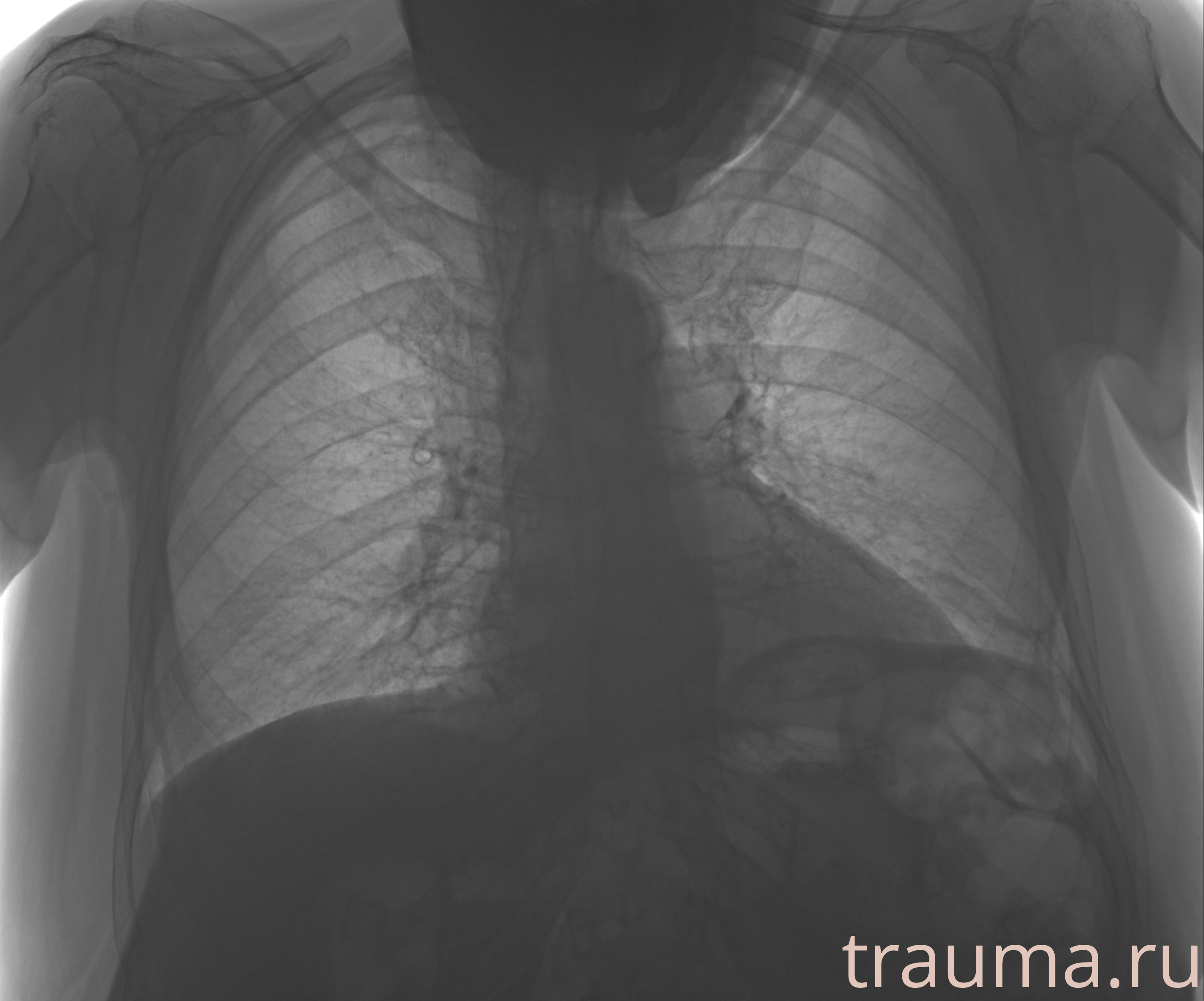 Рентген на дому: по вашему адресу приезжает врач-рентгенолог, травматолог-ортопед с мобильным рентгеновским аппаратом, проводит диагностику травмы или заболевания, делает необходимые рентгенограммы, дает рекомендации по дальнейшему лечению. Получить качественные снимки в домашних условиях возможно благодаря уникальной методике, разработанной МосРентген Центром для института  Склифосовского