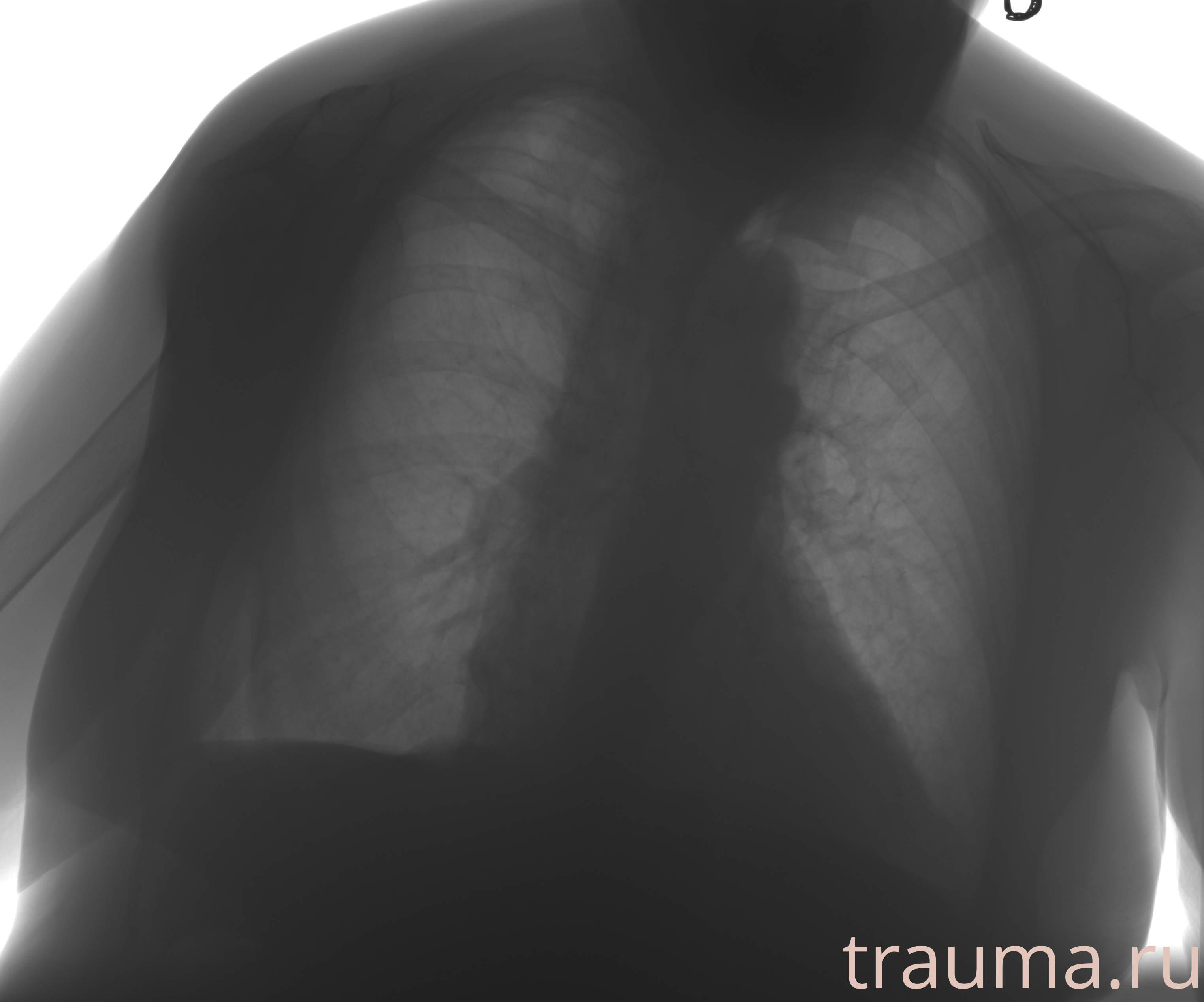 Рентген на дому: по вашему адресу приезжает врач-рентгенолог, травматолог-ортопед с мобильным рентгеновским аппаратом, проводит диагностику травмы или заболевания, делает необходимые рентгенограммы, дает рекомендации по дальнейшему лечению. Получить качественные снимки в домашних условиях возможно благодаря уникальной методике, разработанной МосРентген Центром для института  Склифосовского