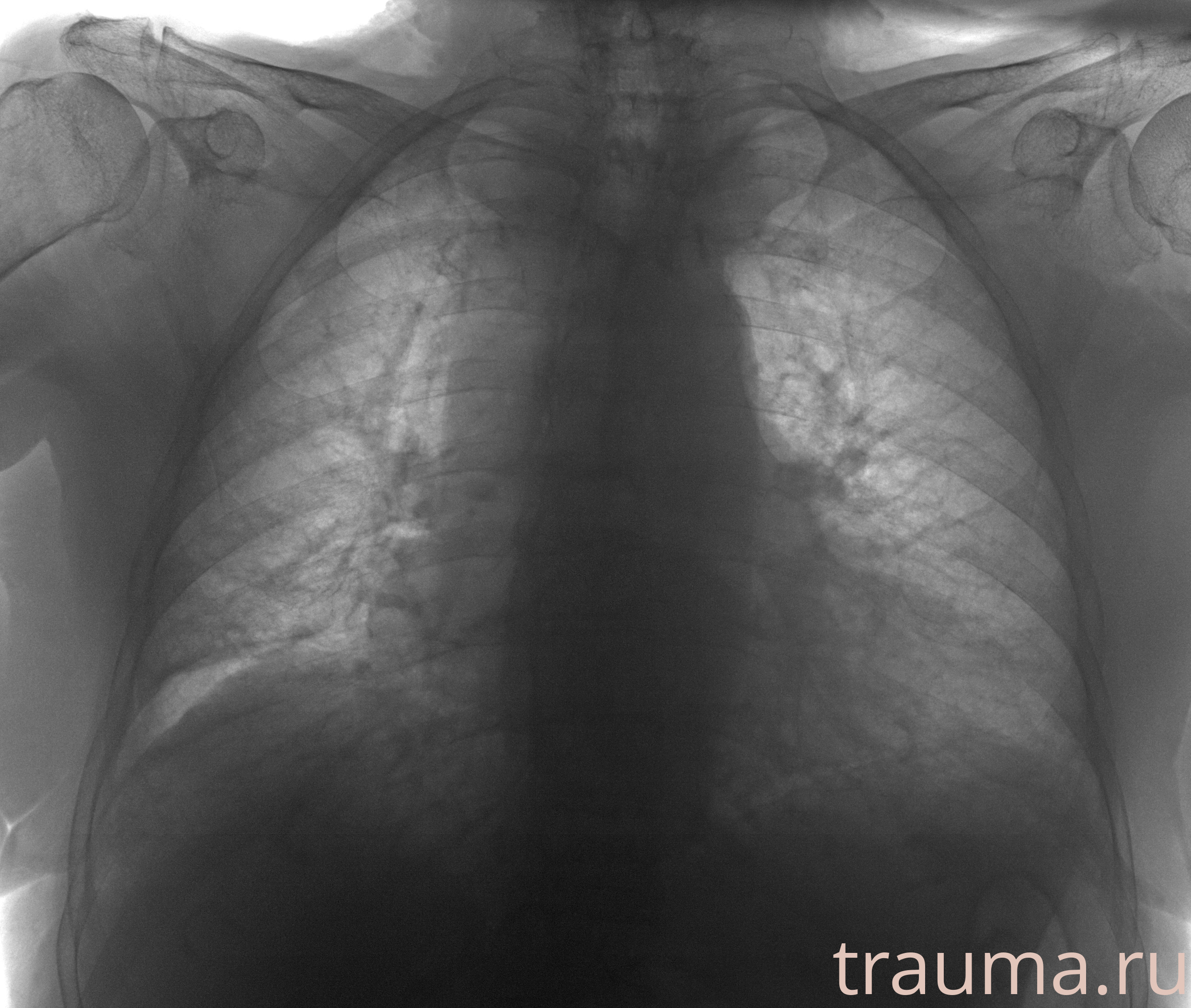 Рентген на дому: по вашему адресу приезжает врач-рентгенолог, травматолог-ортопед с мобильным рентгеновским аппаратом, проводит диагностику травмы или заболевания, делает необходимые рентгенограммы, дает рекомендации по дальнейшему лечению. Получить качественные снимки в домашних условиях возможно благодаря уникальной методике, разработанной МосРентген Центром для института  Склифосовского