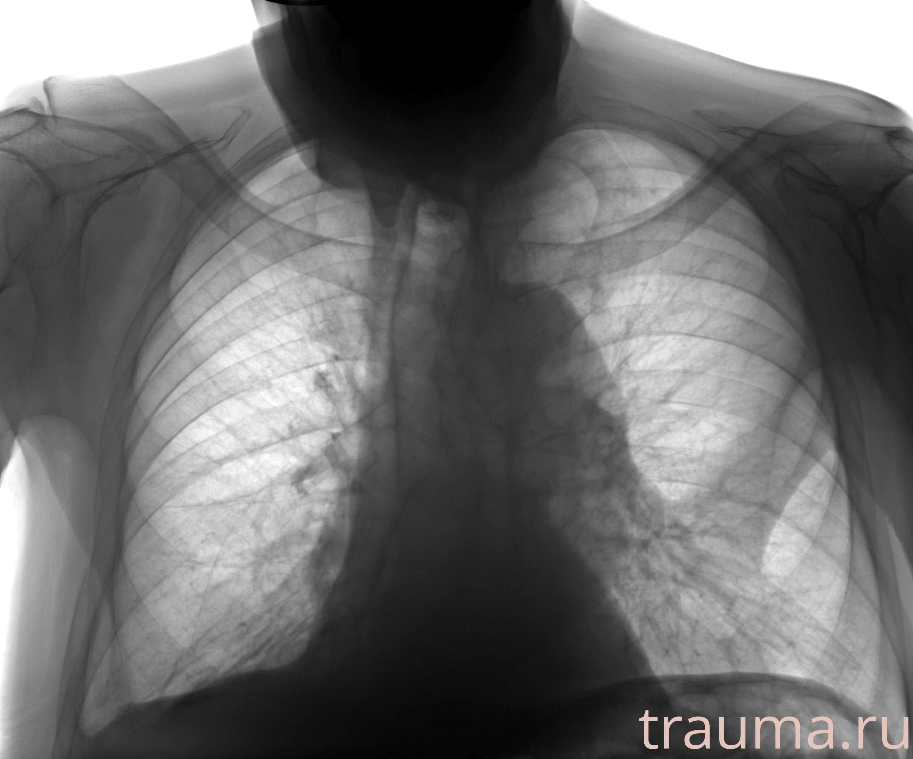 Рентген на дому: по вашему адресу приезжает врач-рентгенолог, травматолог-ортопед с мобильным рентгеновским аппаратом, проводит диагностику травмы или заболевания, делает необходимые рентгенограммы, дает рекомендации по дальнейшему лечению. Получить качественные снимки в домашних условиях возможно благодаря уникальной методике, разработанной МосРентген Центром для института  Склифосовского