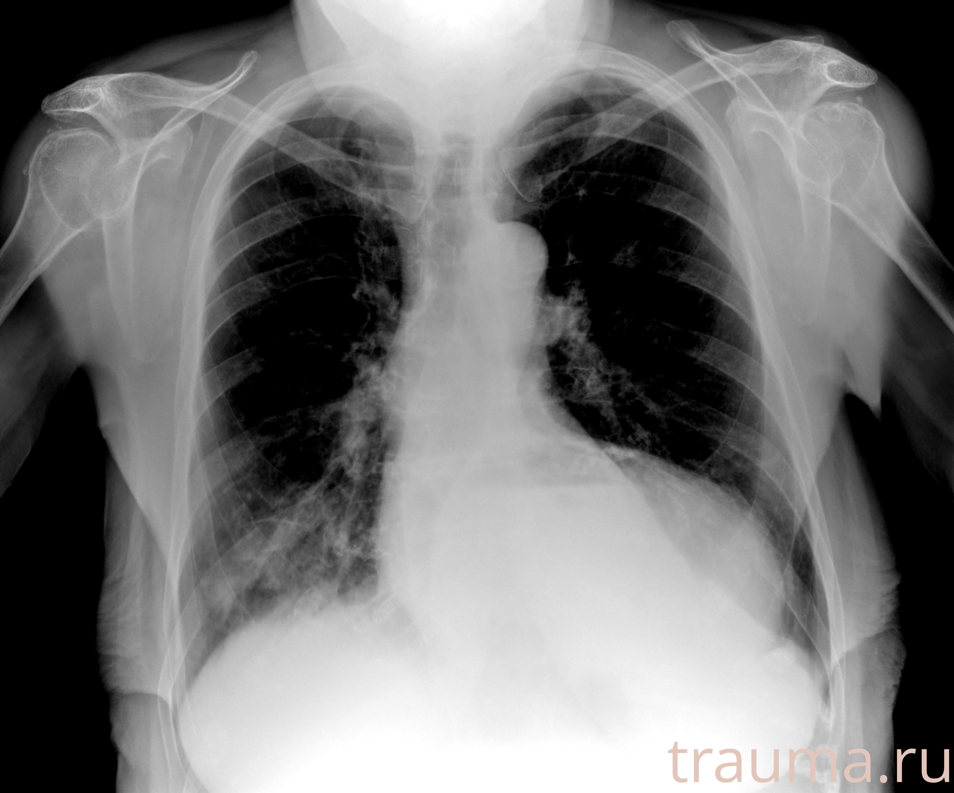 Рентген на дому: по вашему адресу приезжает врач-рентгенолог, травматолог-ортопед с мобильным рентгеновским аппаратом, проводит диагностику травмы или заболевания, делает необходимые рентгенограммы, дает рекомендации по дальнейшему лечению. Получить качественные снимки в домашних условиях возможно благодаря уникальной методике, разработанной МосРентген Центром для института  Склифосовского