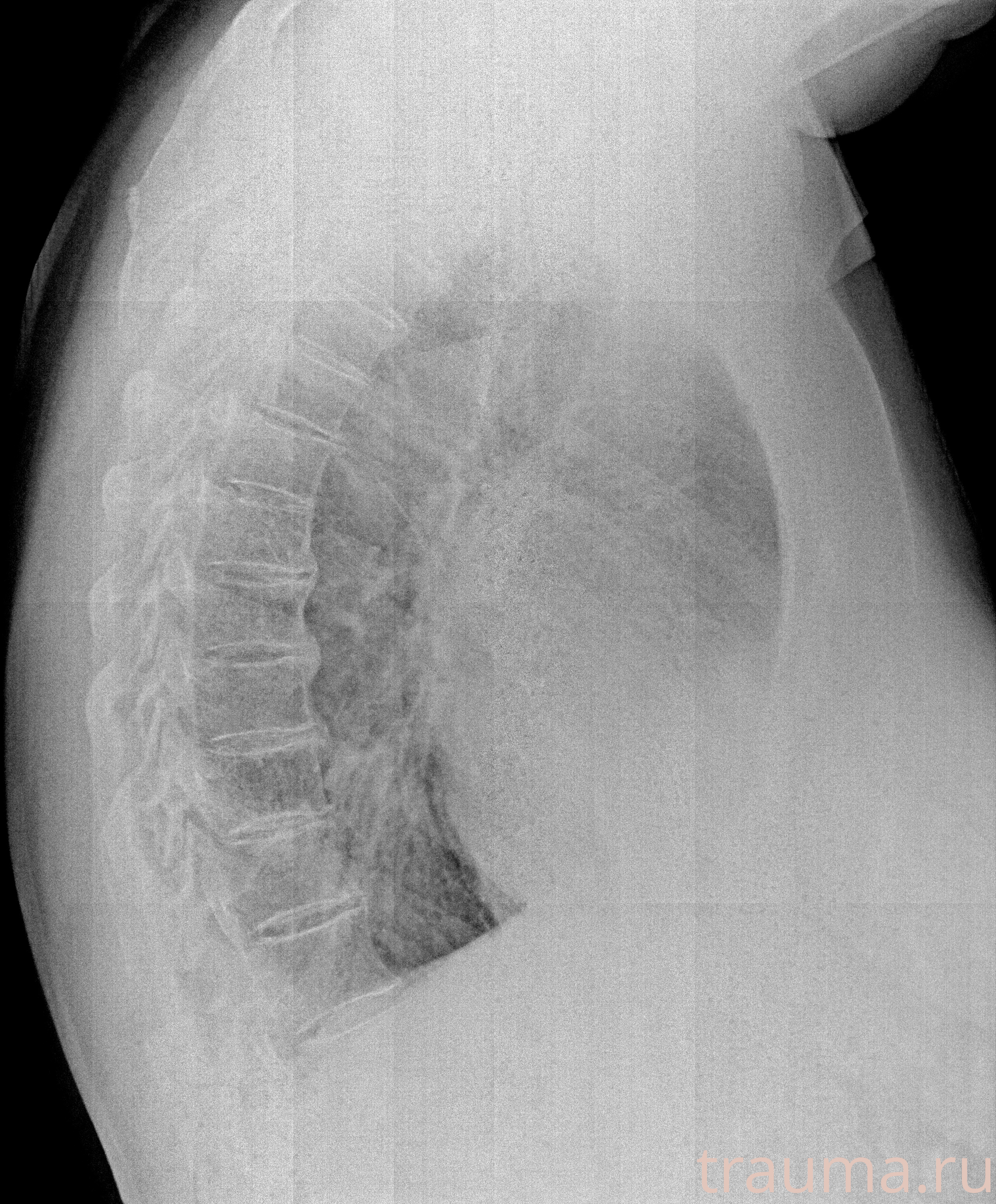Рентген на дому: по вашему адресу приезжает врач-рентгенолог, травматолог-ортопед с мобильным рентгеновским аппаратом, проводит диагностику травмы или заболевания, делает необходимые рентгенограммы, дает рекомендации по дальнейшему лечению. Получить качественные снимки в домашних условиях возможно благодаря уникальной методике, разработанной МосРентген Центром для института  Склифосовского