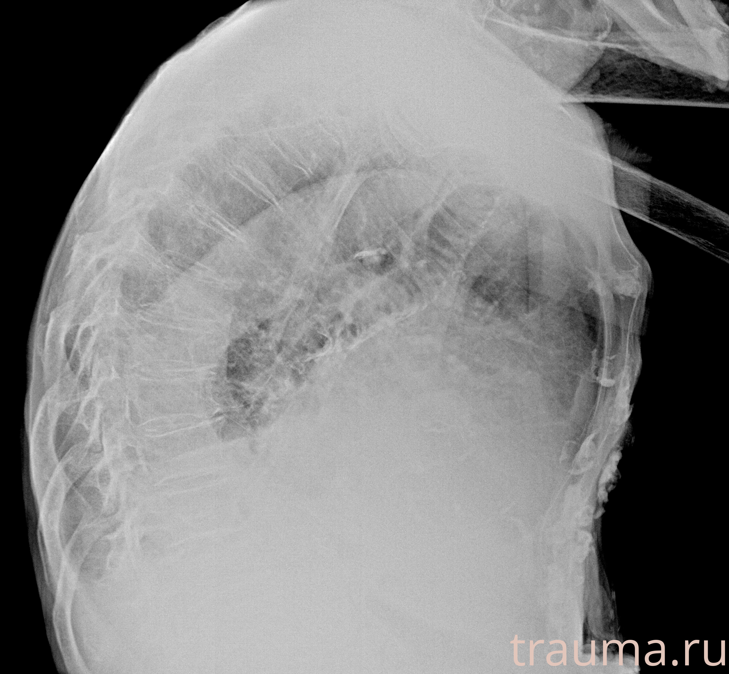 Рентген на дому: по вашему адресу приезжает врач-рентгенолог, травматолог-ортопед с мобильным рентгеновским аппаратом, проводит диагностику травмы или заболевания, делает необходимые рентгенограммы, дает рекомендации по дальнейшему лечению. Получить качественные снимки в домашних условиях возможно благодаря уникальной методике, разработанной МосРентген Центром для института  Склифосовского