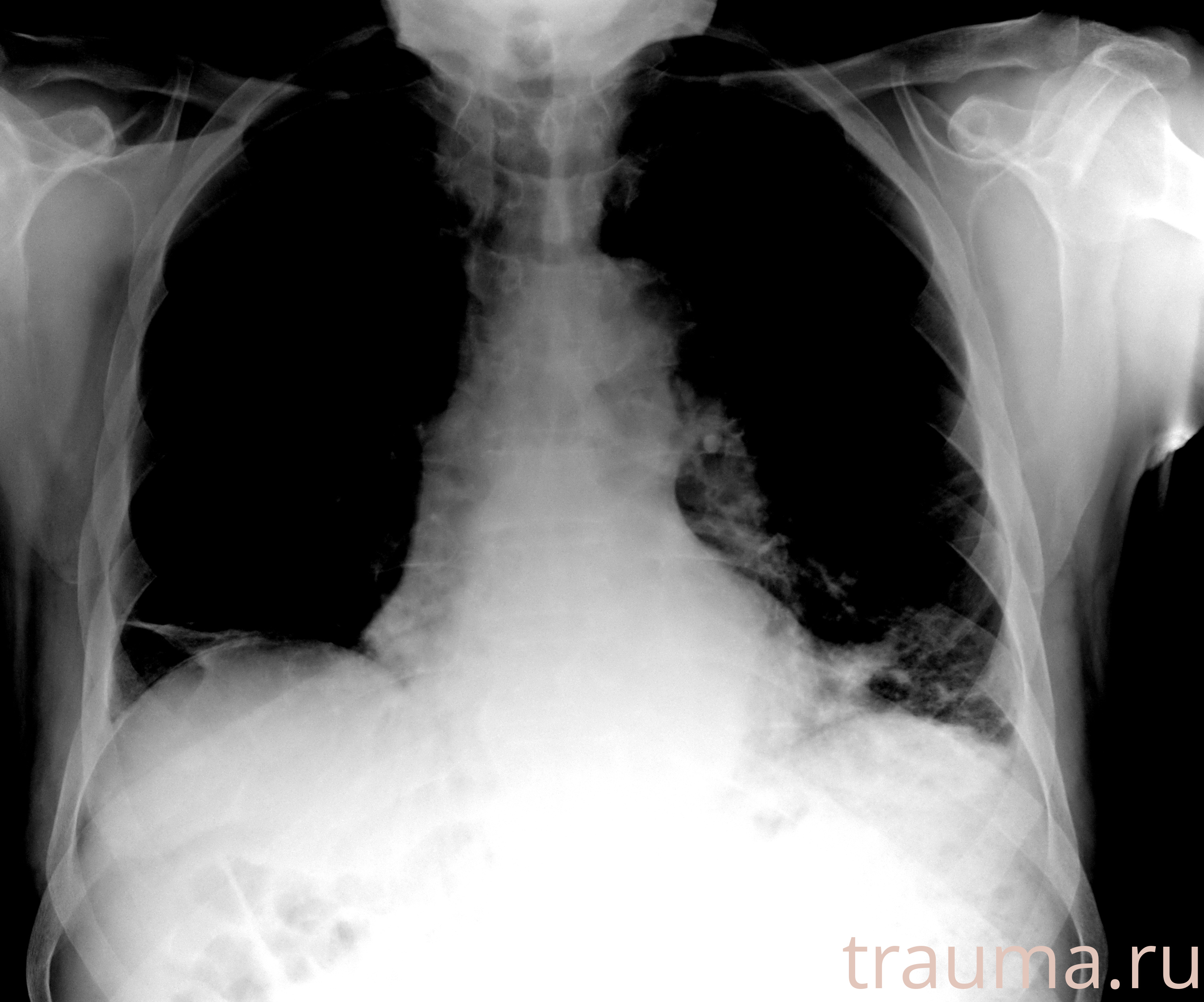 Рентген на дому: по вашему адресу приезжает врач-рентгенолог, травматолог-ортопед с мобильным рентгеновским аппаратом, проводит диагностику травмы или заболевания, делает необходимые рентгенограммы, дает рекомендации по дальнейшему лечению. Получить качественные снимки в домашних условиях возможно благодаря уникальной методике, разработанной МосРентген Центром для института  Склифосовского