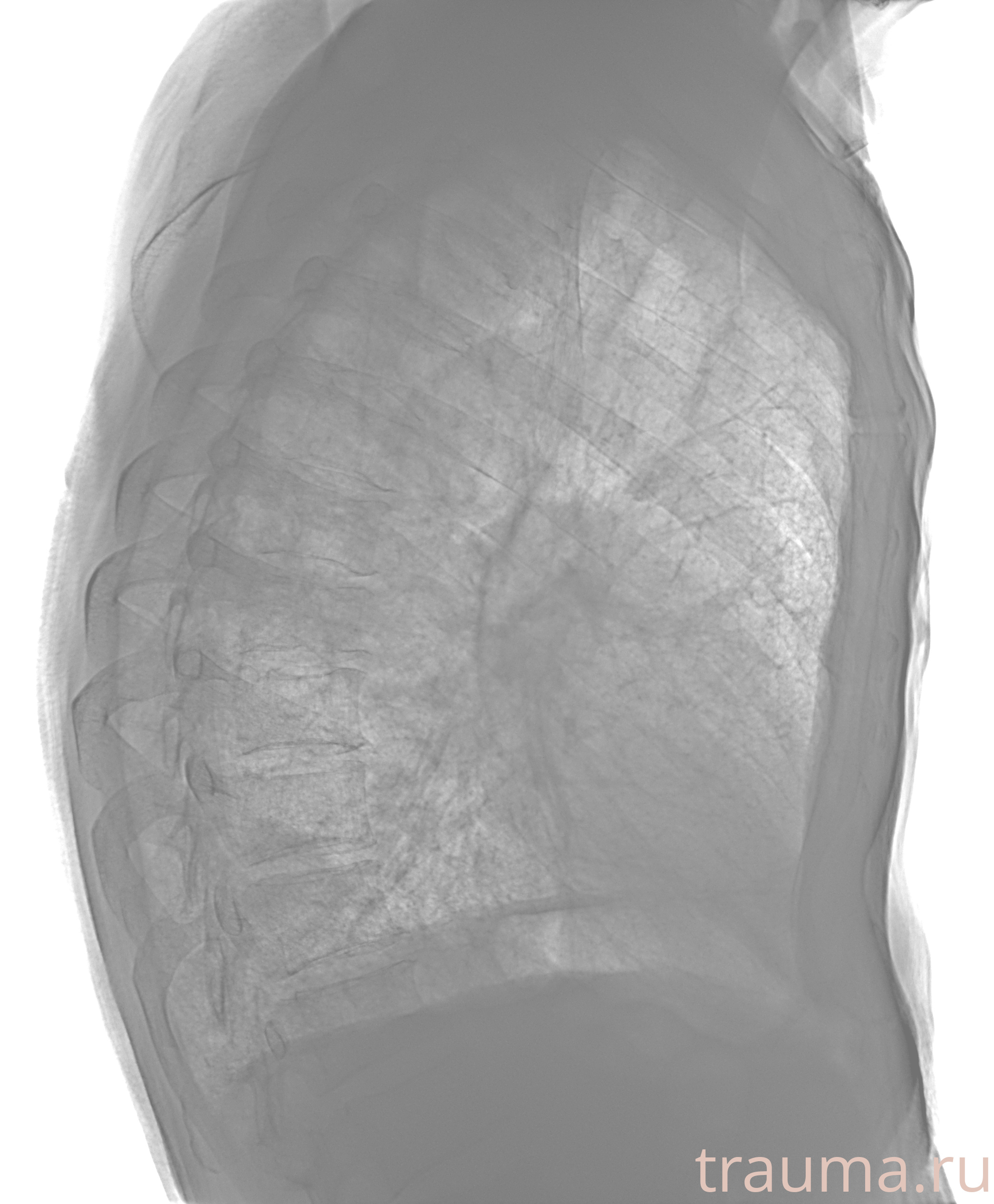 Рентген на дому: по вашему адресу приезжает врач-рентгенолог, травматолог-ортопед с мобильным рентгеновским аппаратом, проводит диагностику травмы или заболевания, делает необходимые рентгенограммы, дает рекомендации по дальнейшему лечению. Получить качественные снимки в домашних условиях возможно благодаря уникальной методике, разработанной МосРентген Центром для института  Склифосовского