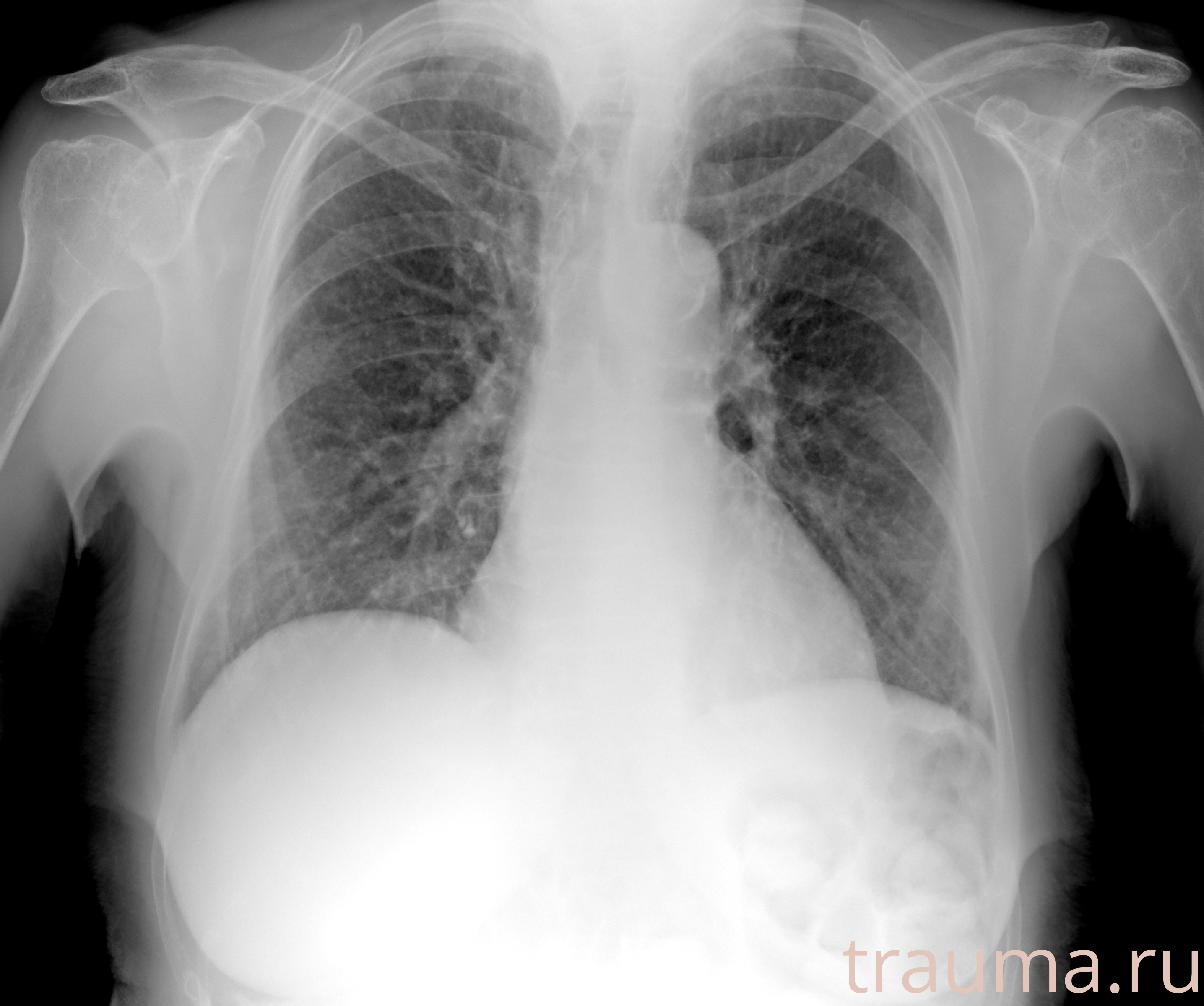 Рентген на дому: по вашему адресу приезжает врач-рентгенолог, травматолог-ортопед с мобильным рентгеновским аппаратом, проводит диагностику травмы или заболевания, делает необходимые рентгенограммы, дает рекомендации по дальнейшему лечению. Получить качественные снимки в домашних условиях возможно благодаря уникальной методике, разработанной МосРентген Центром для института  Склифосовского