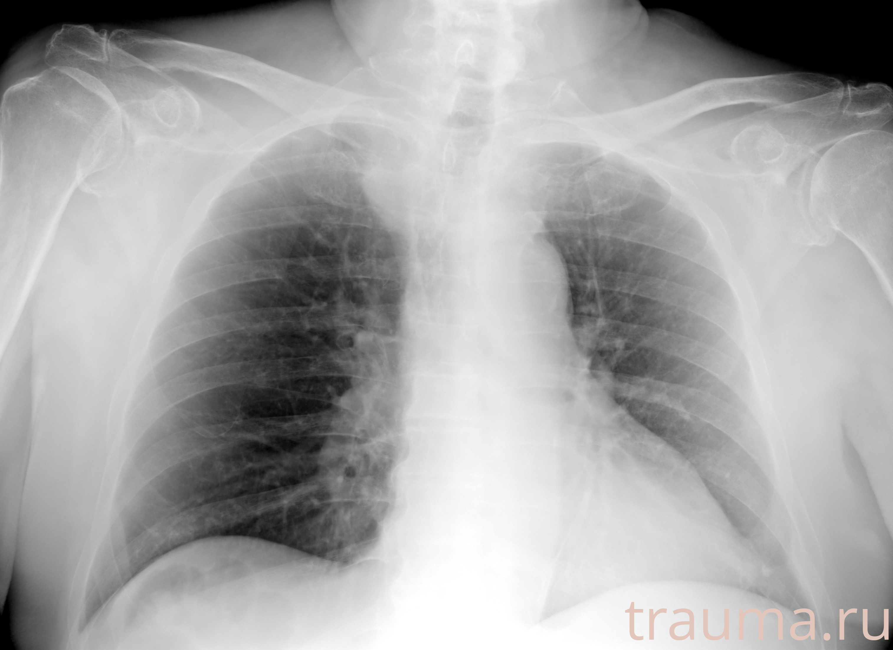 Рентген на дому: по вашему адресу приезжает врач-рентгенолог, травматолог-ортопед с мобильным рентгеновским аппаратом, проводит диагностику травмы или заболевания, делает необходимые рентгенограммы, дает рекомендации по дальнейшему лечению. Получить качественные снимки в домашних условиях возможно благодаря уникальной методике, разработанной МосРентген Центром для института  Склифосовского