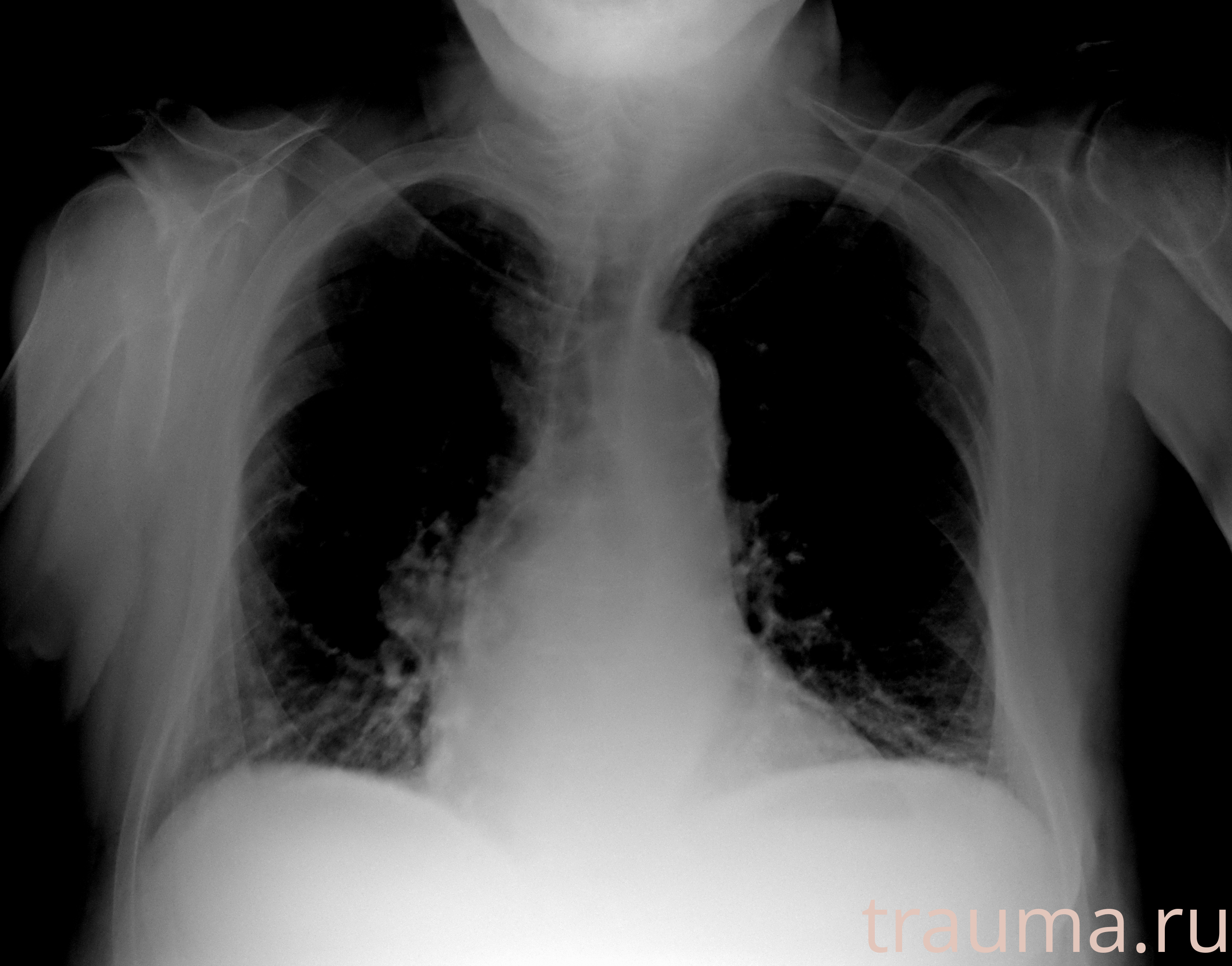 Рентген на дому: по вашему адресу приезжает врач-рентгенолог, травматолог-ортопед с мобильным рентгеновским аппаратом, проводит диагностику травмы или заболевания, делает необходимые рентгенограммы, дает рекомендации по дальнейшему лечению. Получить качественные снимки в домашних условиях возможно благодаря уникальной методике, разработанной МосРентген Центром для института  Склифосовского