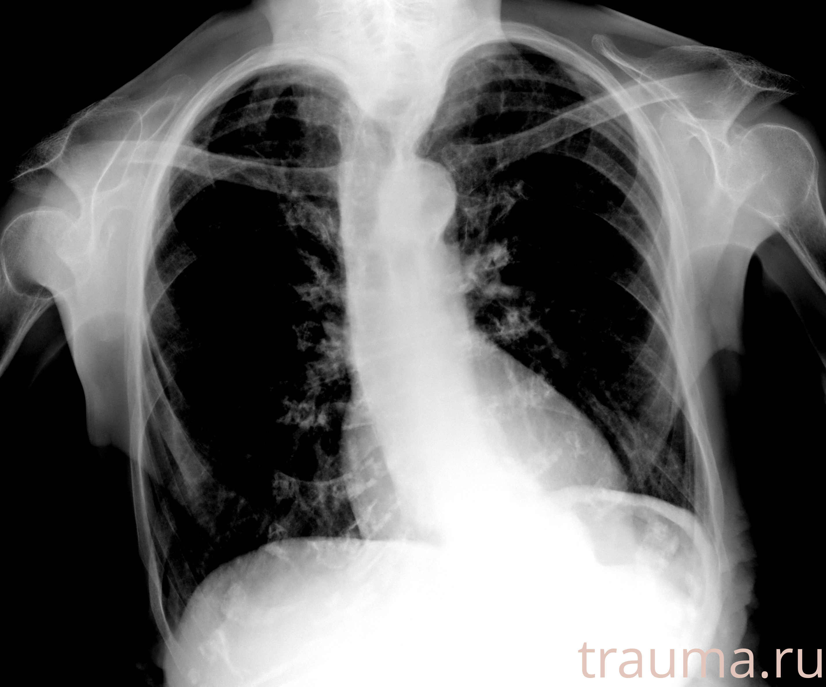 Рентген на дому: по вашему адресу приезжает врач-рентгенолог, травматолог-ортопед с мобильным рентгеновским аппаратом, проводит диагностику травмы или заболевания, делает необходимые рентгенограммы, дает рекомендации по дальнейшему лечению. Получить качественные снимки в домашних условиях возможно благодаря уникальной методике, разработанной МосРентген Центром для института  Склифосовского