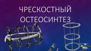 К истории изучения и развития метода чрескостного остеосинтеза на Среднем Урале
К истории изучения и развития метода чрескостного остеосинтеза на Среднем Урале