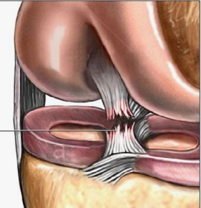 Вариативная анатомия коленного сустава и влияние отдельных ее параметров на топографию передней крестообразной связки