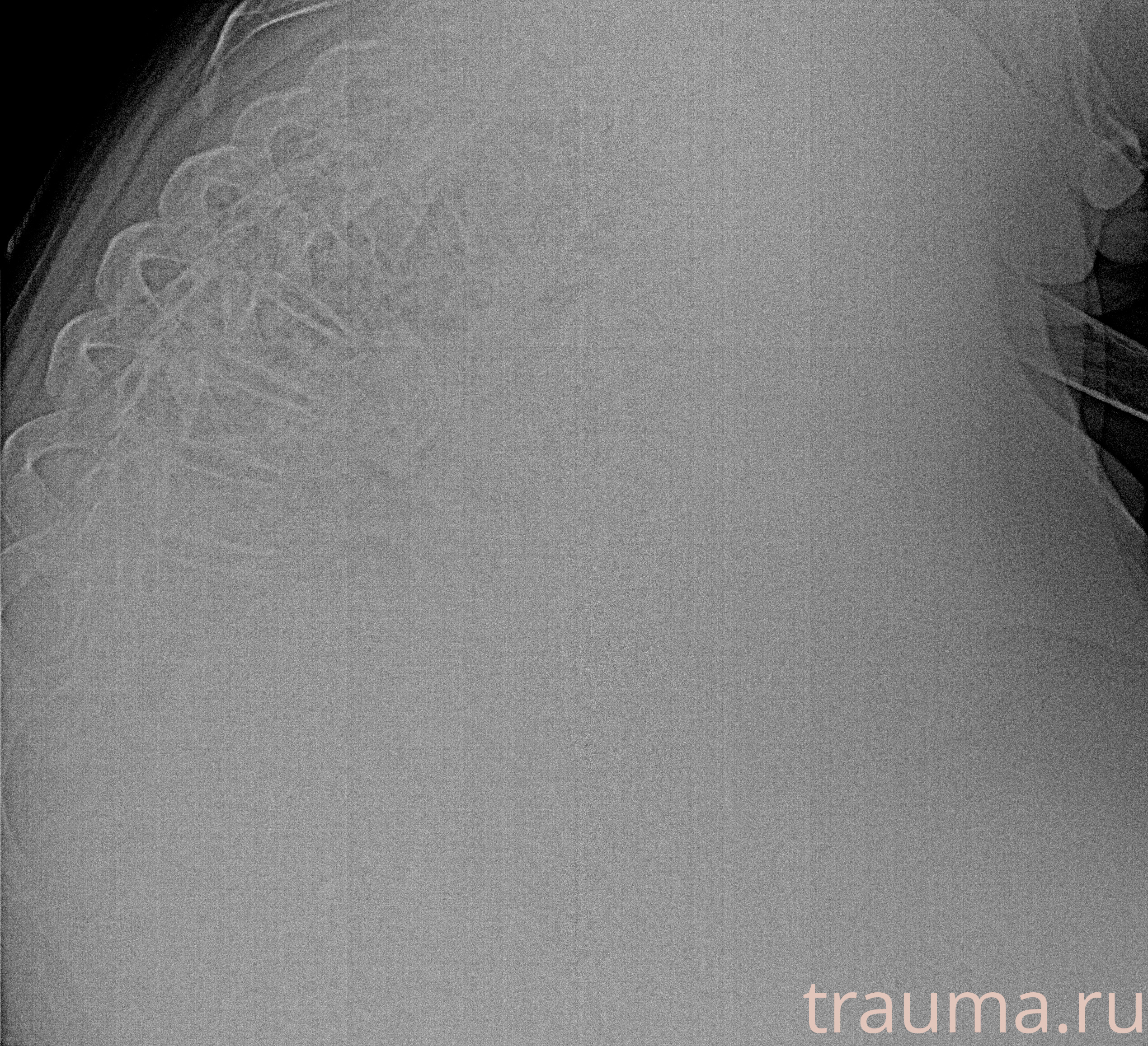 Рентген на дому: по вашему адресу приезжает врач-рентгенолог, травматолог-ортопед с мобильным рентгеновским аппаратом, проводит диагностику травмы или заболевания, делает необходимые рентгенограммы, дает рекомендации по дальнейшему лечению. Получить качественные снимки в домашних условиях возможно благодаря уникальной методике, разработанной МосРентген Центром для института  Склифосовского