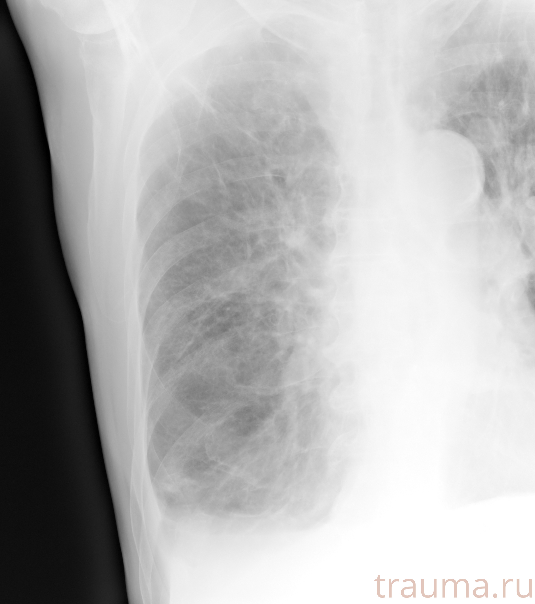 Рентген на дому: по вашему адресу приезжает врач-рентгенолог, травматолог-ортопед с мобильным рентгеновским аппаратом, проводит диагностику травмы или заболевания, делает необходимые рентгенограммы, дает рекомендации по дальнейшему лечению. Получить качественные снимки в домашних условиях возможно благодаря уникальной методике, разработанной МосРентген Центром для института  Склифосовского