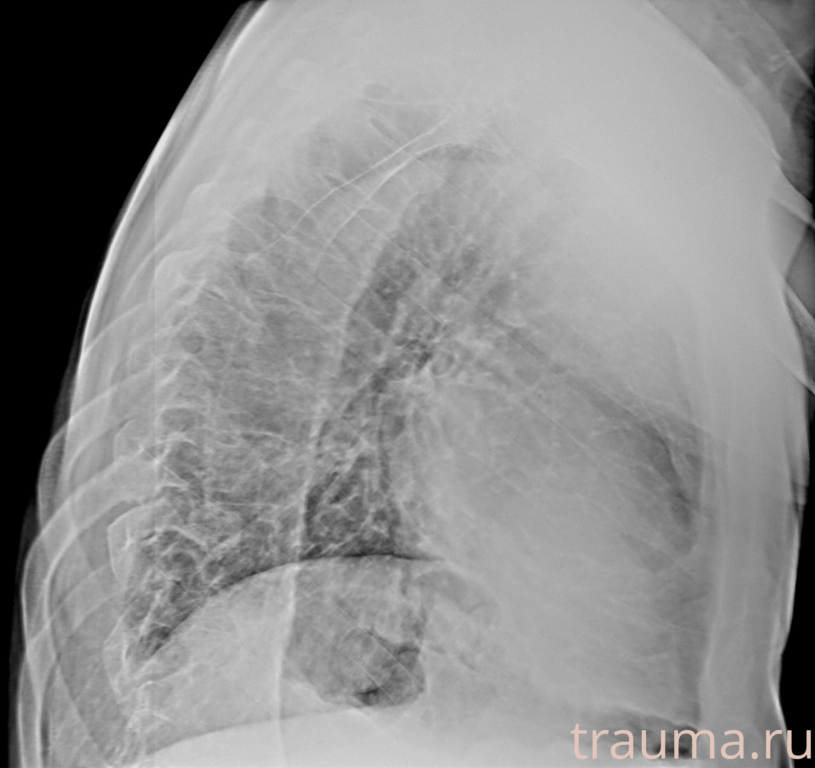 Рентген на дому: по вашему адресу приезжает врач-рентгенолог, травматолог-ортопед с мобильным рентгеновским аппаратом, проводит диагностику травмы или заболевания, делает необходимые рентгенограммы, дает рекомендации по дальнейшему лечению. Получить качественные снимки в домашних условиях возможно благодаря уникальной методике, разработанной МосРентген Центром для института  Склифосовского