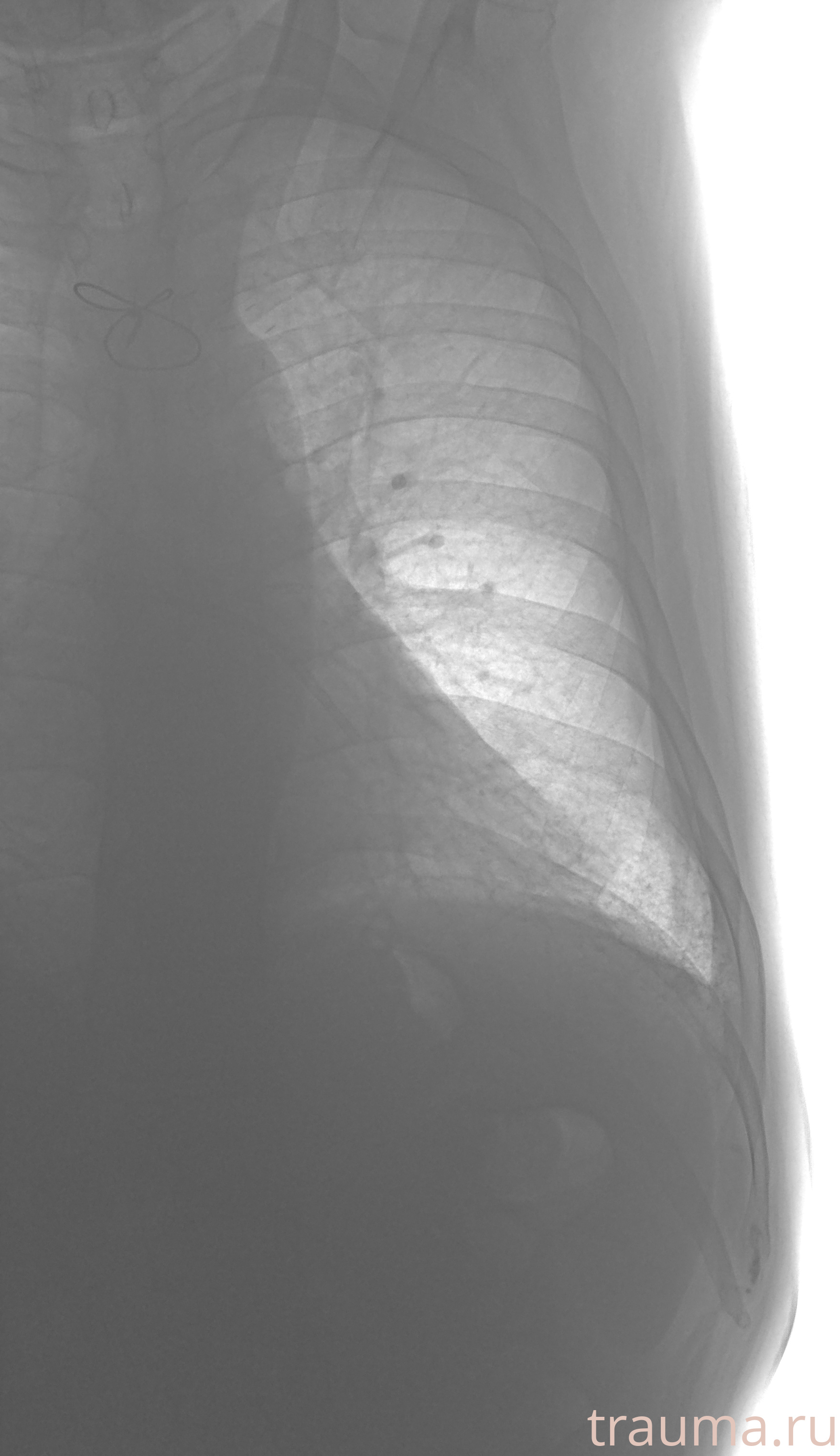 Рентген на дому: по вашему адресу приезжает врач-рентгенолог, травматолог-ортопед с мобильным рентгеновским аппаратом, проводит диагностику травмы или заболевания, делает необходимые рентгенограммы, дает рекомендации по дальнейшему лечению. Получить качественные снимки в домашних условиях возможно благодаря уникальной методике, разработанной МосРентген Центром для института  Склифосовского