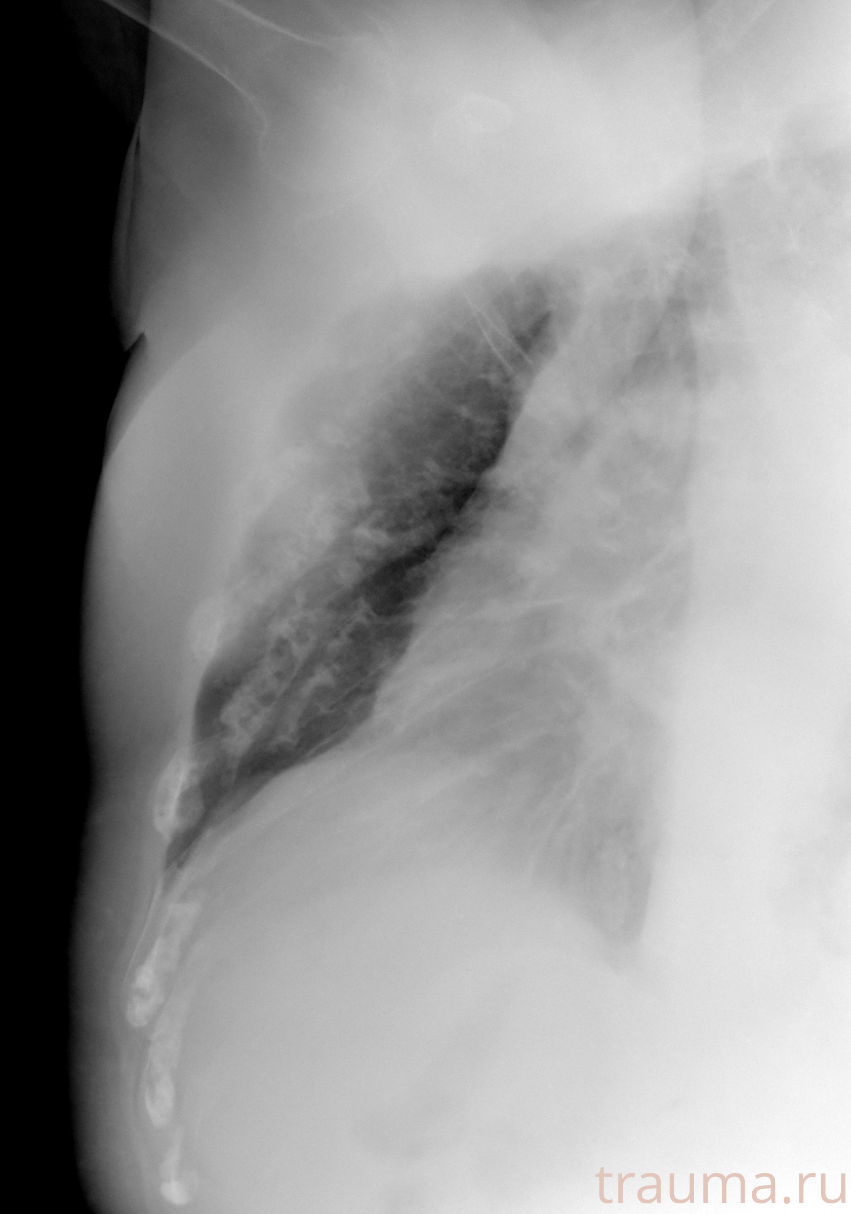 Рентген на дому: по вашему адресу приезжает врач-рентгенолог, травматолог-ортопед с мобильным рентгеновским аппаратом, проводит диагностику травмы или заболевания, делает необходимые рентгенограммы, дает рекомендации по дальнейшему лечению. Получить качественные снимки в домашних условиях возможно благодаря уникальной методике, разработанной МосРентген Центром для института  Склифосовского