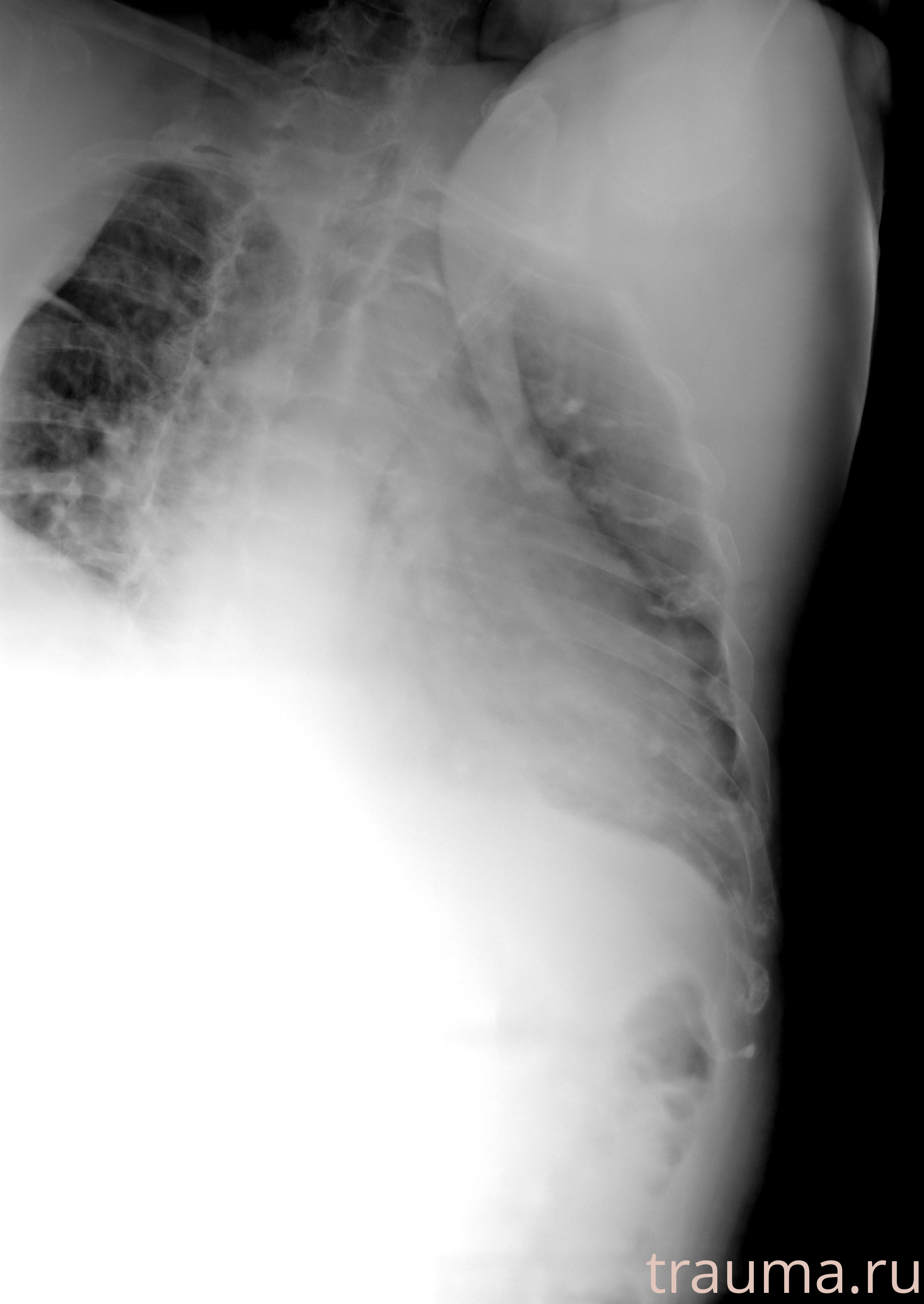 Рентген на дому: по вашему адресу приезжает врач-рентгенолог, травматолог-ортопед с мобильным рентгеновским аппаратом, проводит диагностику травмы или заболевания, делает необходимые рентгенограммы, дает рекомендации по дальнейшему лечению. Получить качественные снимки в домашних условиях возможно благодаря уникальной методике, разработанной МосРентген Центром для института  Склифосовского