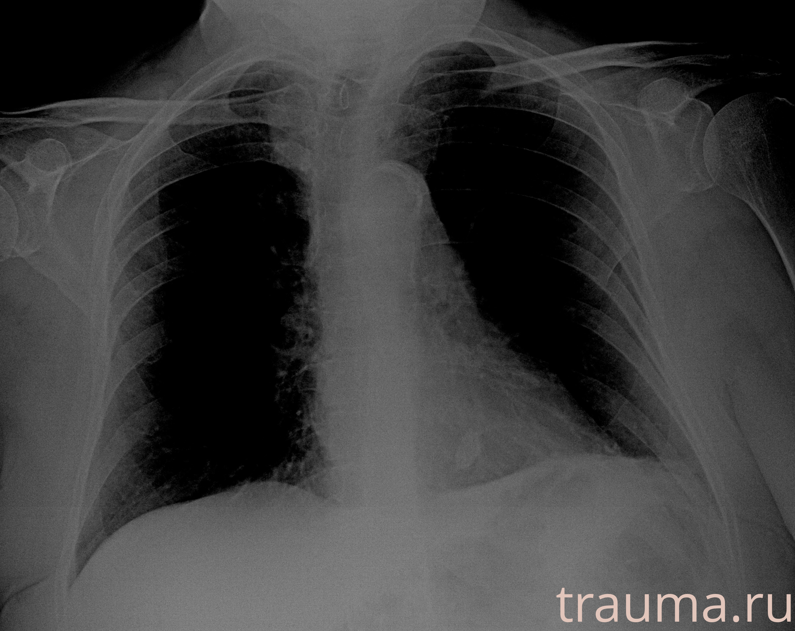 Рентген на дому: по вашему адресу приезжает врач-рентгенолог, травматолог-ортопед с мобильным рентгеновским аппаратом, проводит диагностику травмы или заболевания, делает необходимые рентгенограммы, дает рекомендации по дальнейшему лечению. Получить качественные снимки в домашних условиях возможно благодаря уникальной методике, разработанной МосРентген Центром для института  Склифосовского