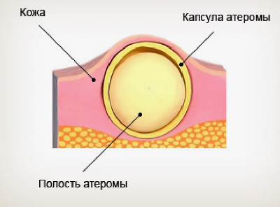 Десяток шишек на голове… Десяток шишек на голове…
