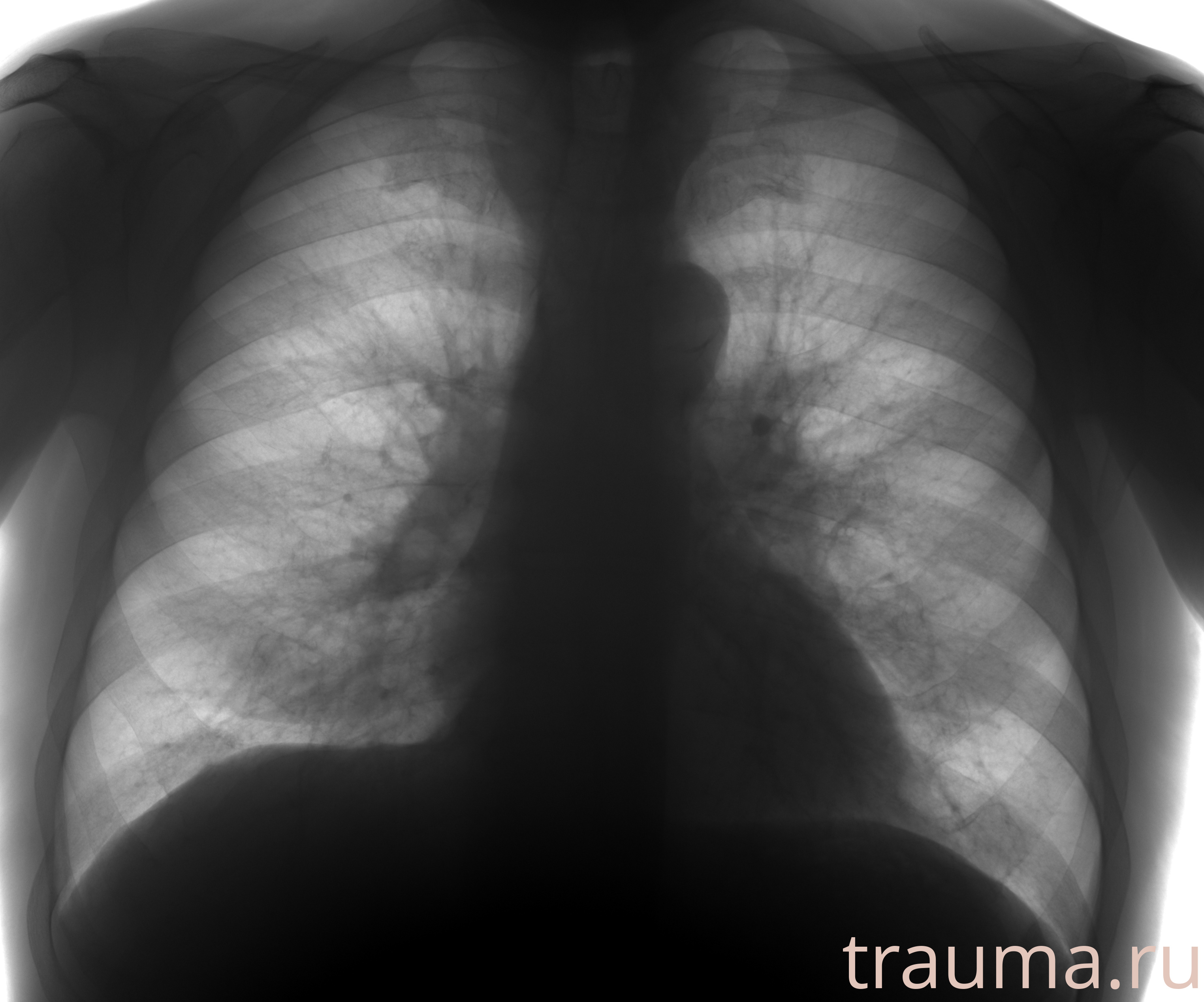 Рентген на дому: по вашему адресу приезжает врач-рентгенолог, травматолог-ортопед с мобильным рентгеновским аппаратом, проводит диагностику травмы или заболевания, делает необходимые рентгенограммы, дает рекомендации по дальнейшему лечению. Получить качественные снимки в домашних условиях возможно благодаря уникальной методике, разработанной МосРентген Центром для института  Склифосовского