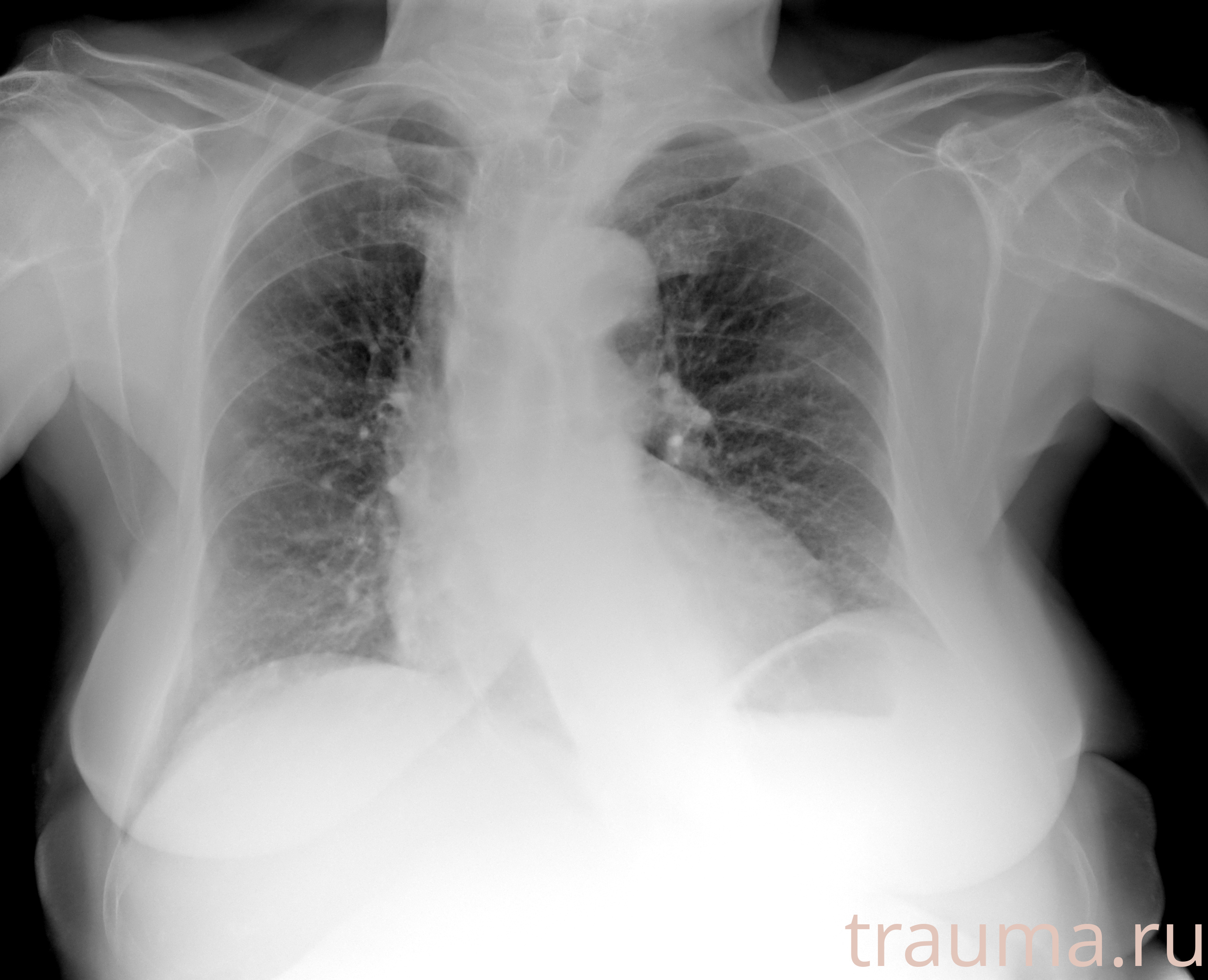 Рентген на дому: по вашему адресу приезжает врач-рентгенолог, травматолог-ортопед с мобильным рентгеновским аппаратом, проводит диагностику травмы или заболевания, делает необходимые рентгенограммы, дает рекомендации по дальнейшему лечению. Получить качественные снимки в домашних условиях возможно благодаря уникальной методике, разработанной МосРентген Центром для института  Склифосовского