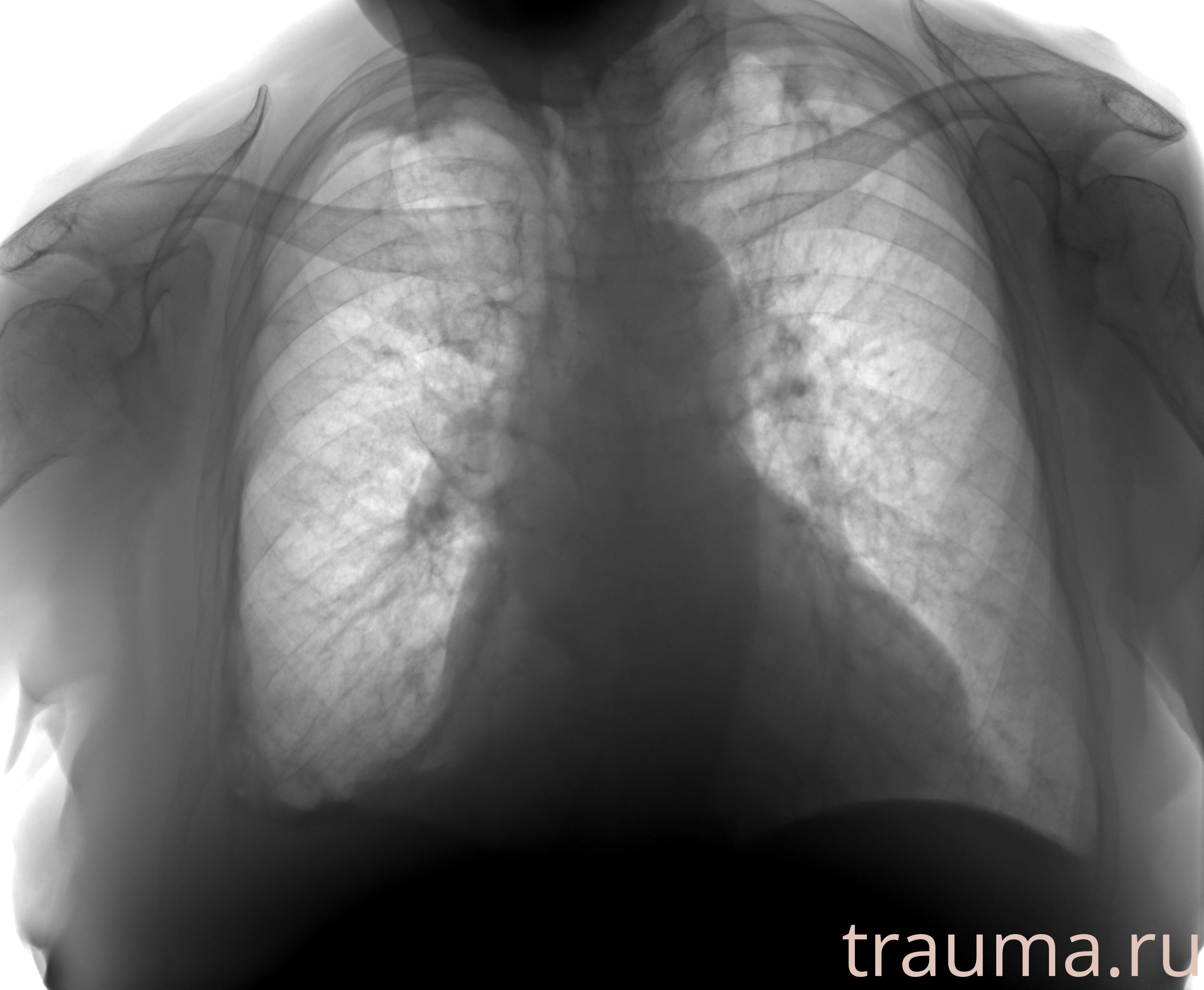 Рентген на дому: по вашему адресу приезжает врач-рентгенолог, травматолог-ортопед с мобильным рентгеновским аппаратом, проводит диагностику травмы или заболевания, делает необходимые рентгенограммы, дает рекомендации по дальнейшему лечению. Получить качественные снимки в домашних условиях возможно благодаря уникальной методике, разработанной МосРентген Центром для института  Склифосовского