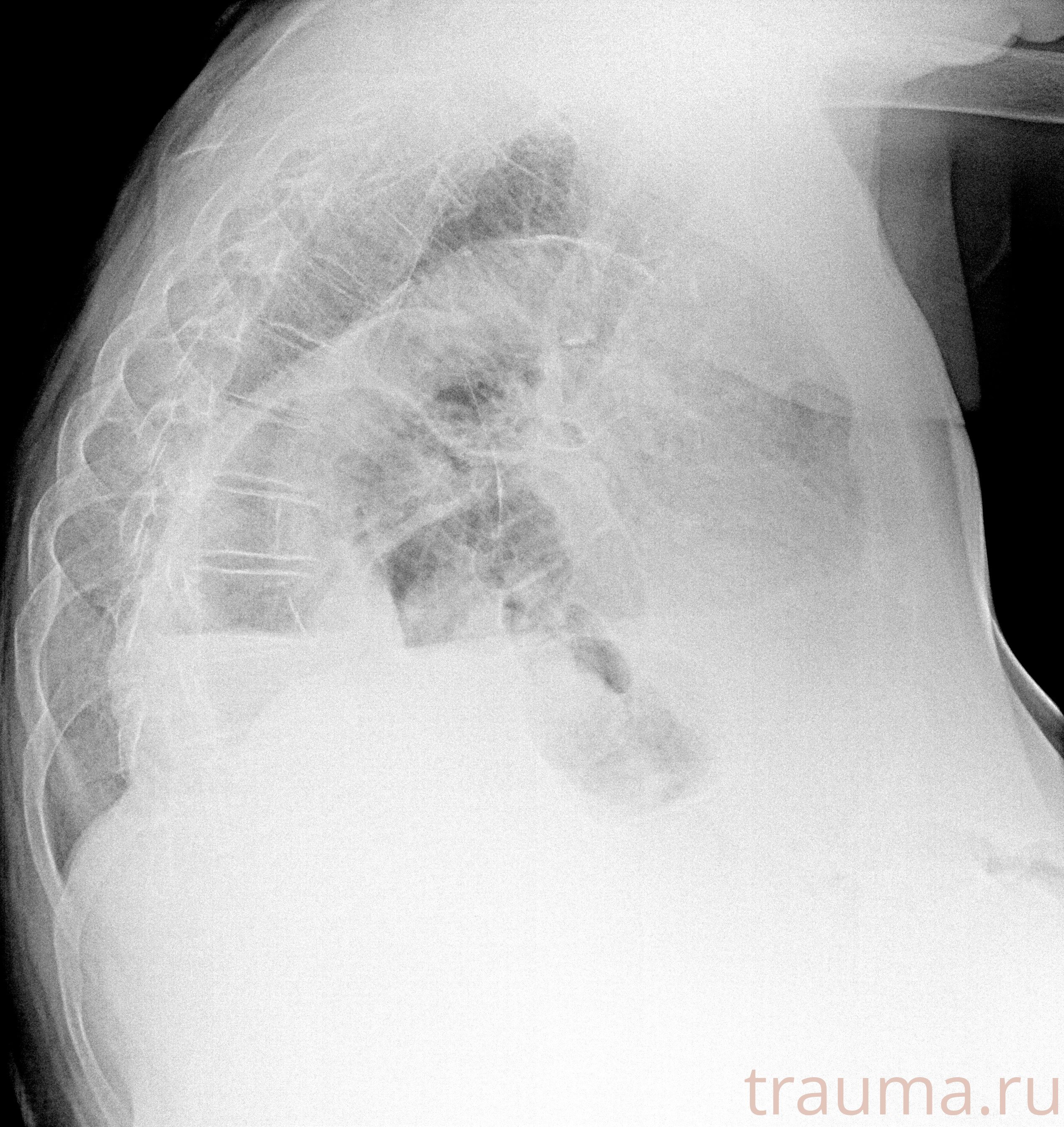 Рентген на дому: по вашему адресу приезжает врач-рентгенолог, травматолог-ортопед с мобильным рентгеновским аппаратом, проводит диагностику травмы или заболевания, делает необходимые рентгенограммы, дает рекомендации по дальнейшему лечению. Получить качественные снимки в домашних условиях возможно благодаря уникальной методике, разработанной МосРентген Центром для института  Склифосовского