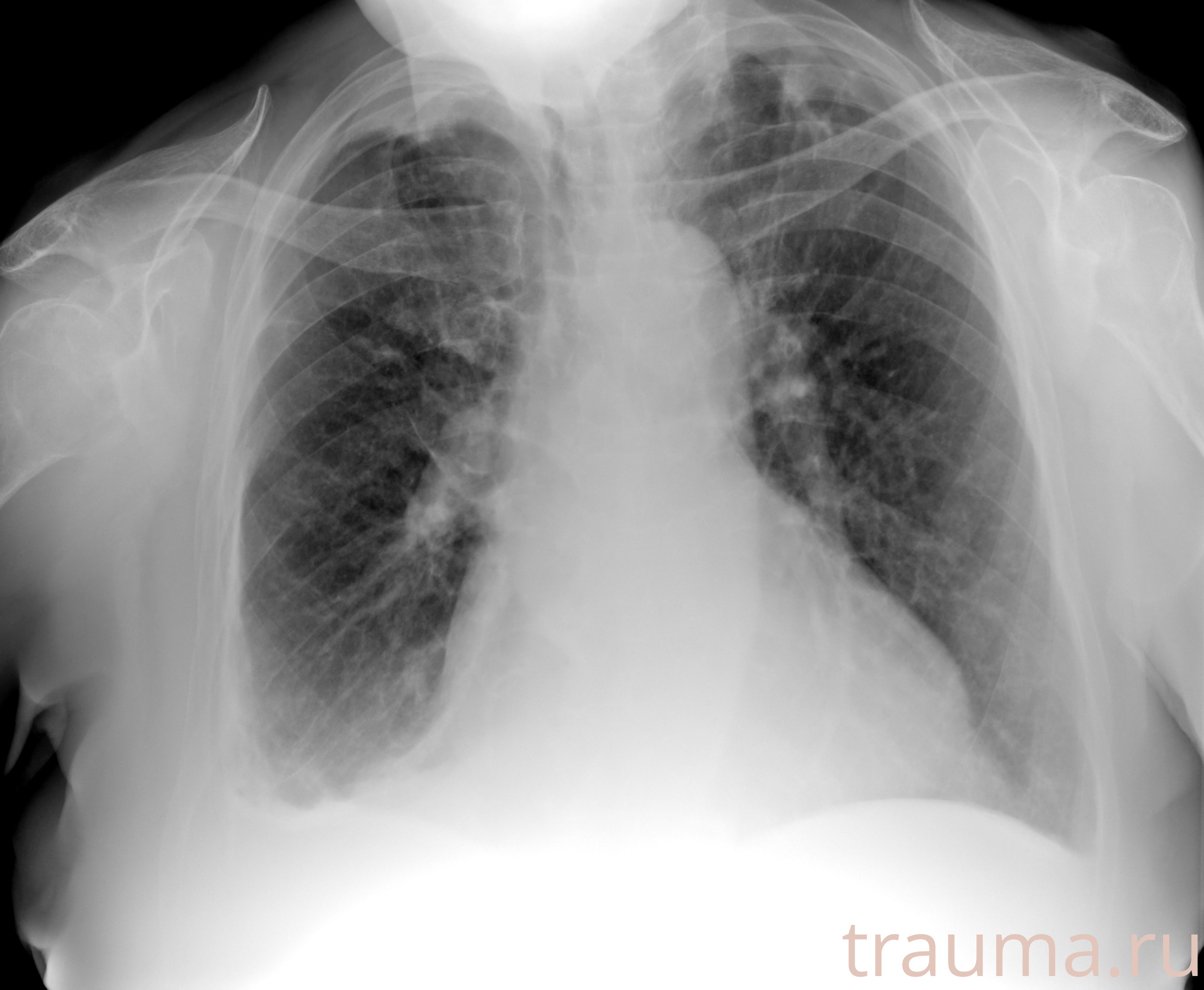 Рентген на дому: по вашему адресу приезжает врач-рентгенолог, травматолог-ортопед с мобильным рентгеновским аппаратом, проводит диагностику травмы или заболевания, делает необходимые рентгенограммы, дает рекомендации по дальнейшему лечению. Получить качественные снимки в домашних условиях возможно благодаря уникальной методике, разработанной МосРентген Центром для института  Склифосовского