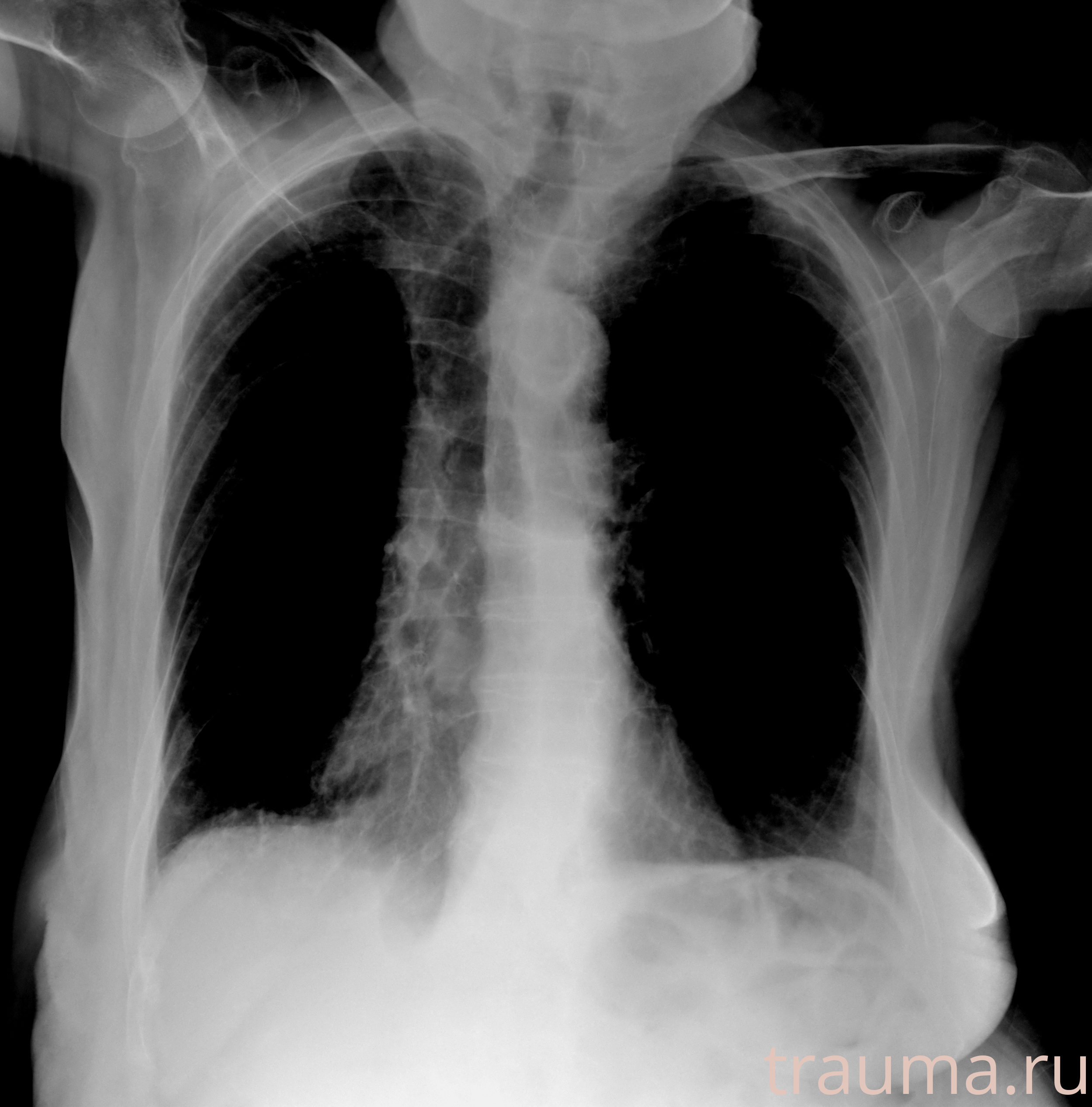 Рентген на дому: по вашему адресу приезжает врач-рентгенолог, травматолог-ортопед с мобильным рентгеновским аппаратом, проводит диагностику травмы или заболевания, делает необходимые рентгенограммы, дает рекомендации по дальнейшему лечению. Получить качественные снимки в домашних условиях возможно благодаря уникальной методике, разработанной МосРентген Центром для института  Склифосовского