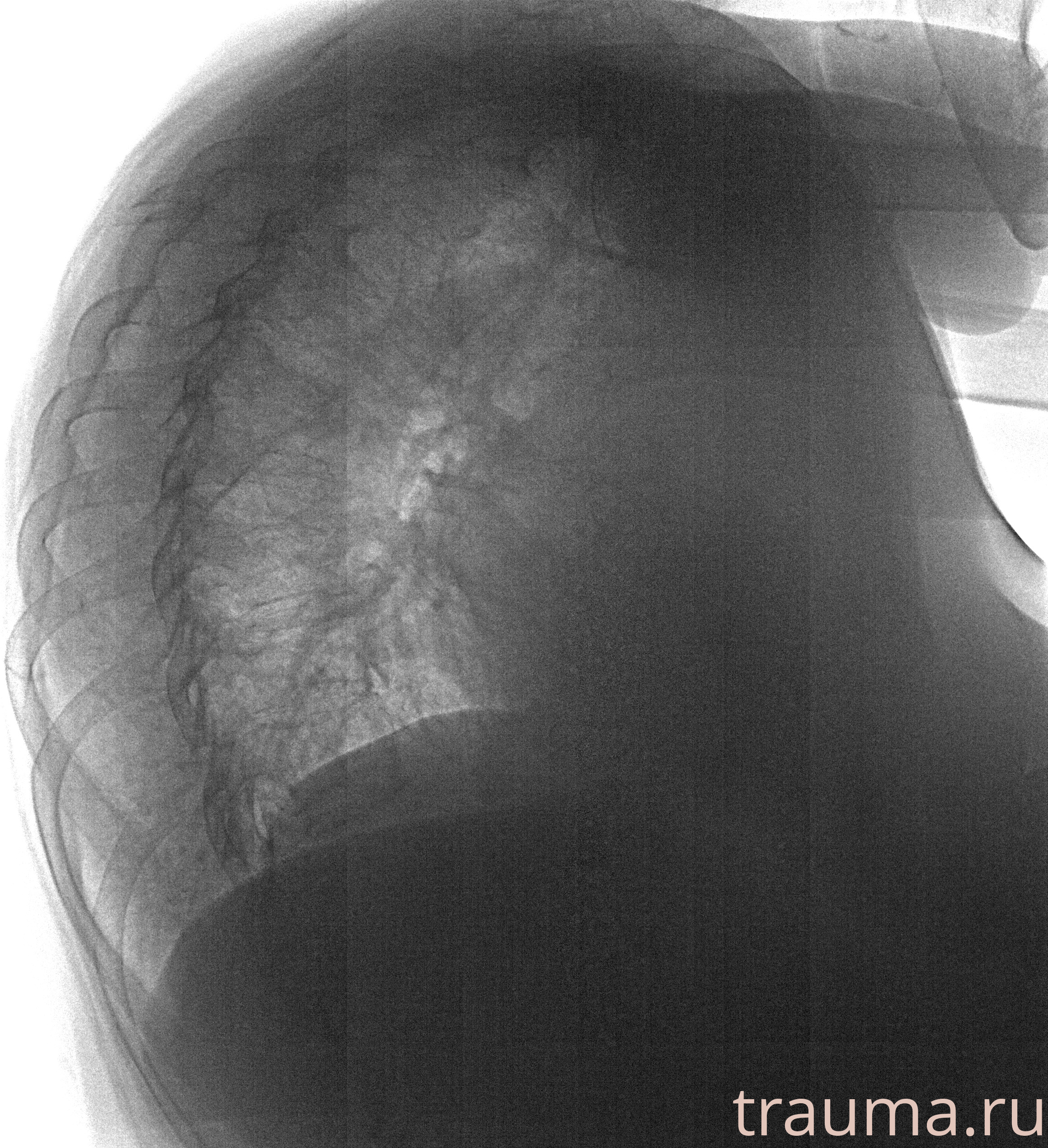 Рентген на дому: по вашему адресу приезжает врач-рентгенолог, травматолог-ортопед с мобильным рентгеновским аппаратом, проводит диагностику травмы или заболевания, делает необходимые рентгенограммы, дает рекомендации по дальнейшему лечению. Получить качественные снимки в домашних условиях возможно благодаря уникальной методике, разработанной МосРентген Центром для института  Склифосовского