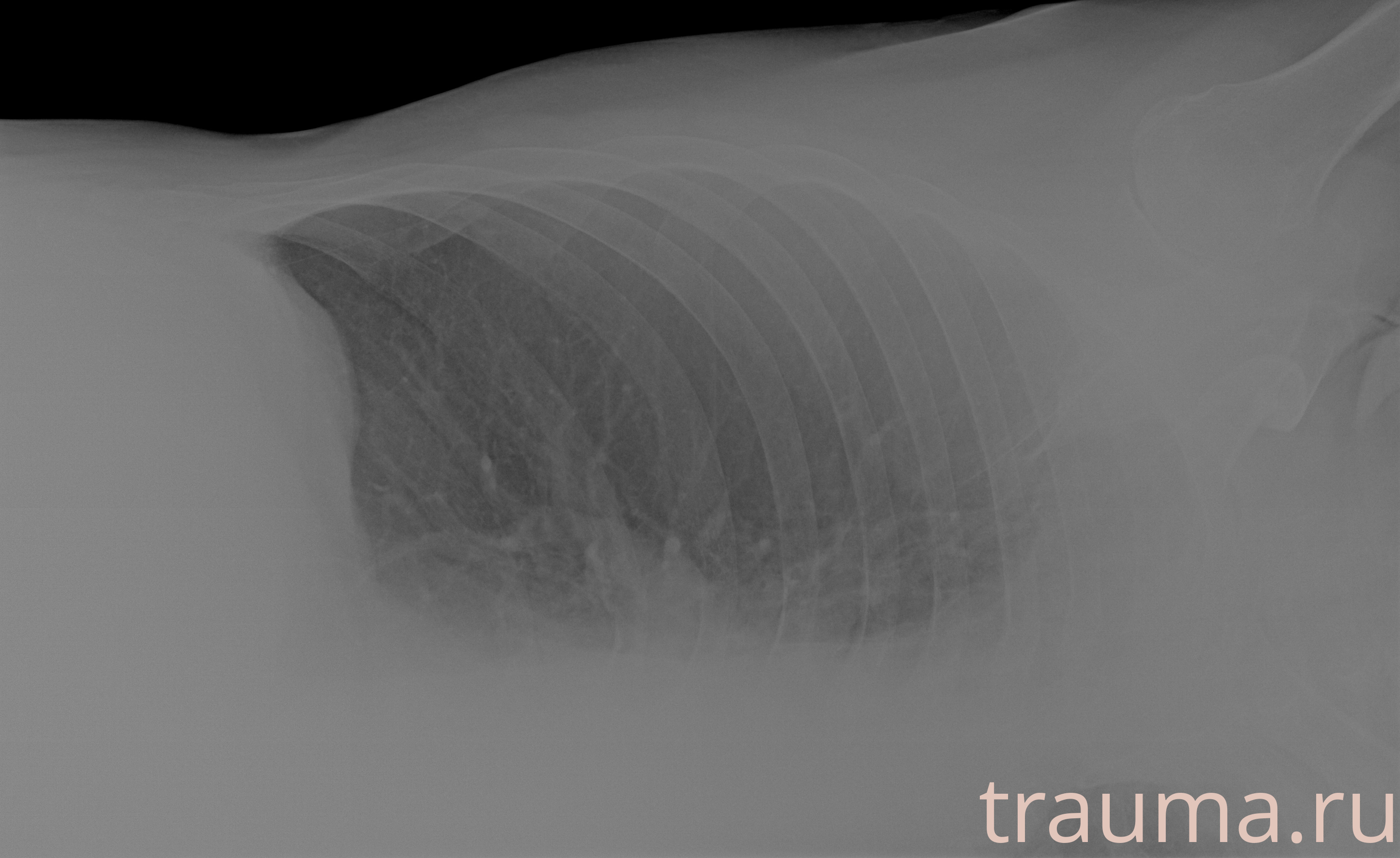 Рентген на дому: по вашему адресу приезжает врач-рентгенолог, травматолог-ортопед с мобильным рентгеновским аппаратом, проводит диагностику травмы или заболевания, делает необходимые рентгенограммы, дает рекомендации по дальнейшему лечению. Получить качественные снимки в домашних условиях возможно благодаря уникальной методике, разработанной МосРентген Центром для института  Склифосовского