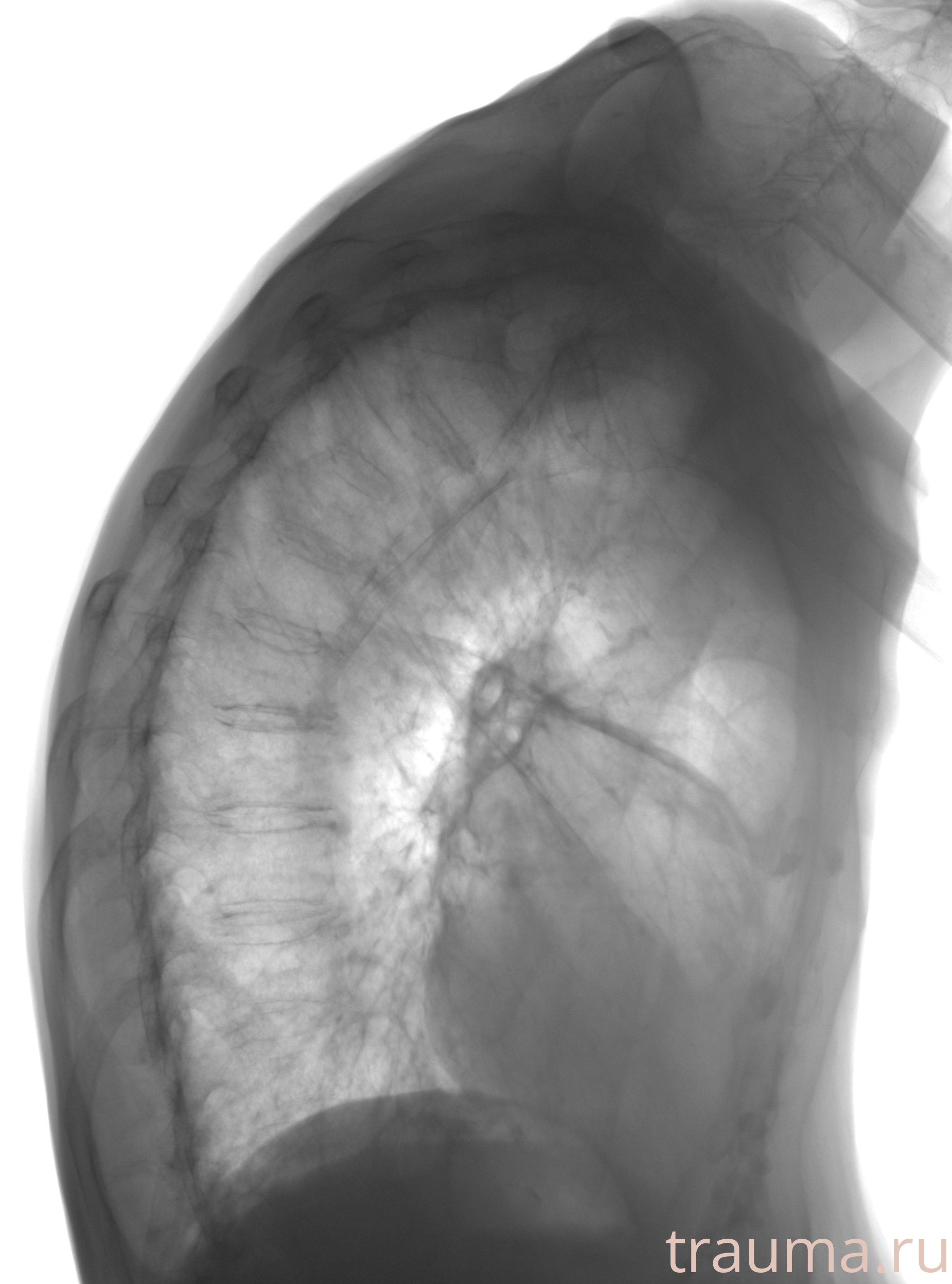 Рентген на дому: по вашему адресу приезжает врач-рентгенолог, травматолог-ортопед с мобильным рентгеновским аппаратом, проводит диагностику травмы или заболевания, делает необходимые рентгенограммы, дает рекомендации по дальнейшему лечению. Получить качественные снимки в домашних условиях возможно благодаря уникальной методике, разработанной МосРентген Центром для института  Склифосовского