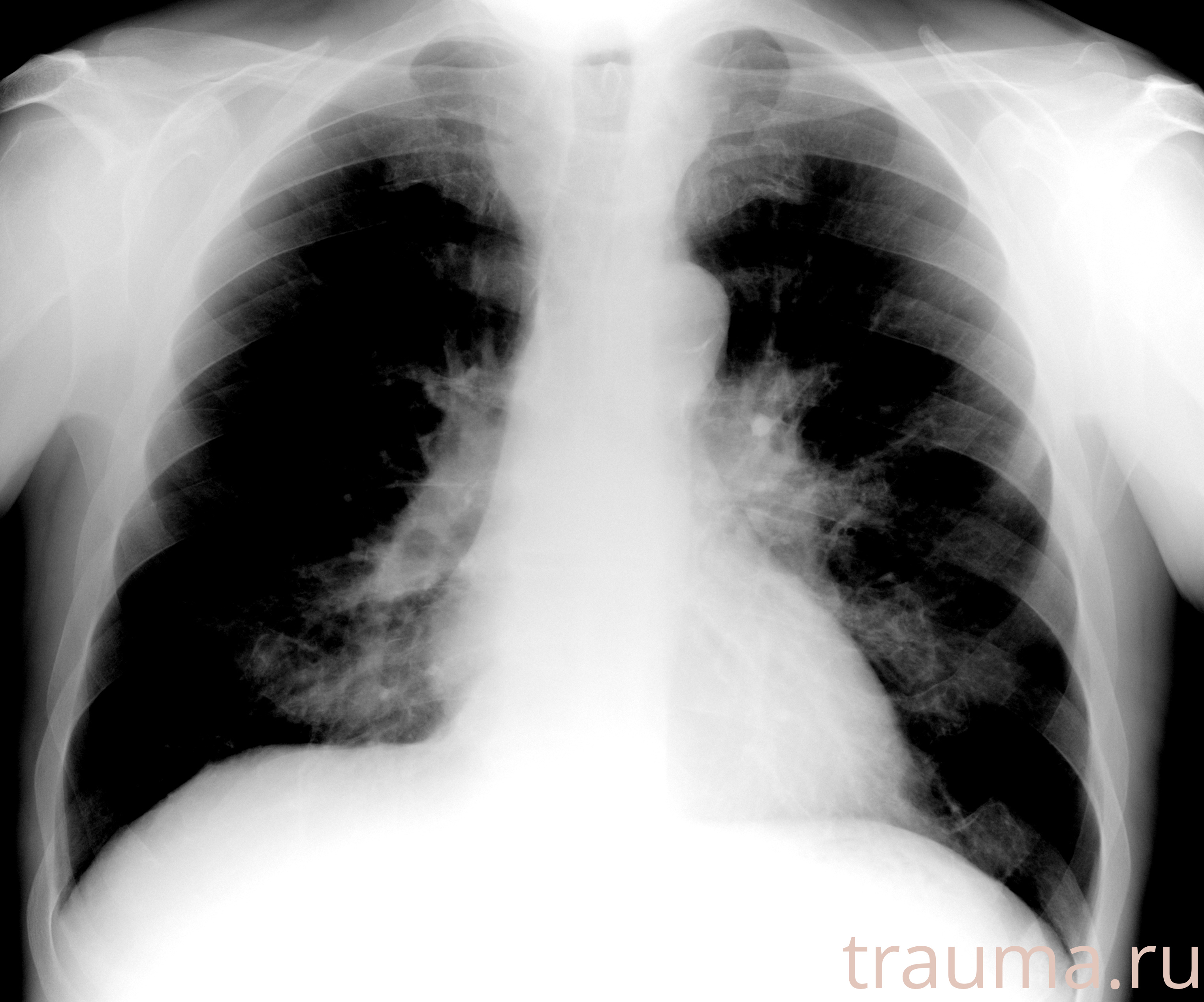 Рентген на дому: по вашему адресу приезжает врач-рентгенолог, травматолог-ортопед с мобильным рентгеновским аппаратом, проводит диагностику травмы или заболевания, делает необходимые рентгенограммы, дает рекомендации по дальнейшему лечению. Получить качественные снимки в домашних условиях возможно благодаря уникальной методике, разработанной МосРентген Центром для института  Склифосовского