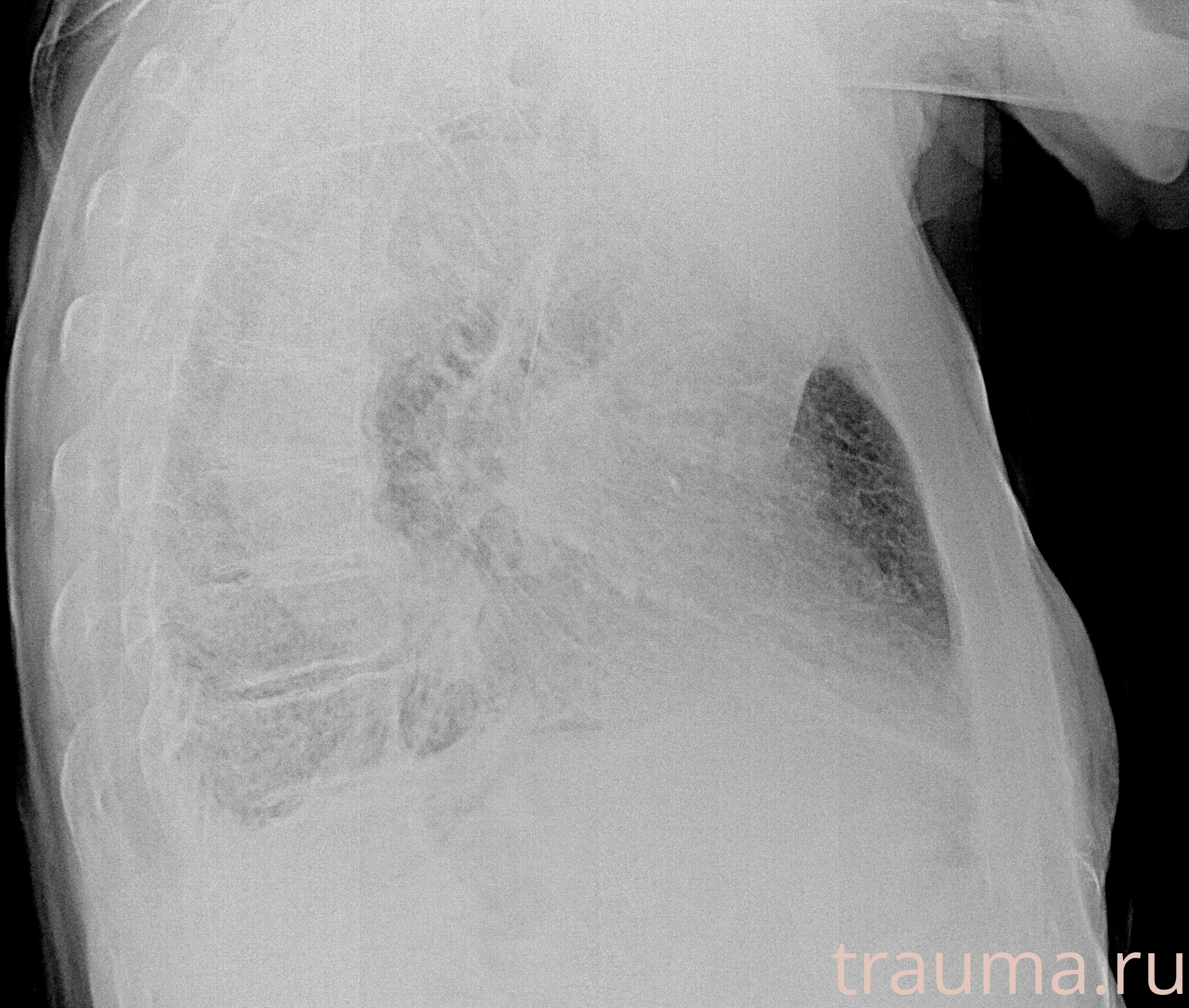 Рентген на дому: по вашему адресу приезжает врач-рентгенолог, травматолог-ортопед с мобильным рентгеновским аппаратом, проводит диагностику травмы или заболевания, делает необходимые рентгенограммы, дает рекомендации по дальнейшему лечению. Получить качественные снимки в домашних условиях возможно благодаря уникальной методике, разработанной МосРентген Центром для института  Склифосовского