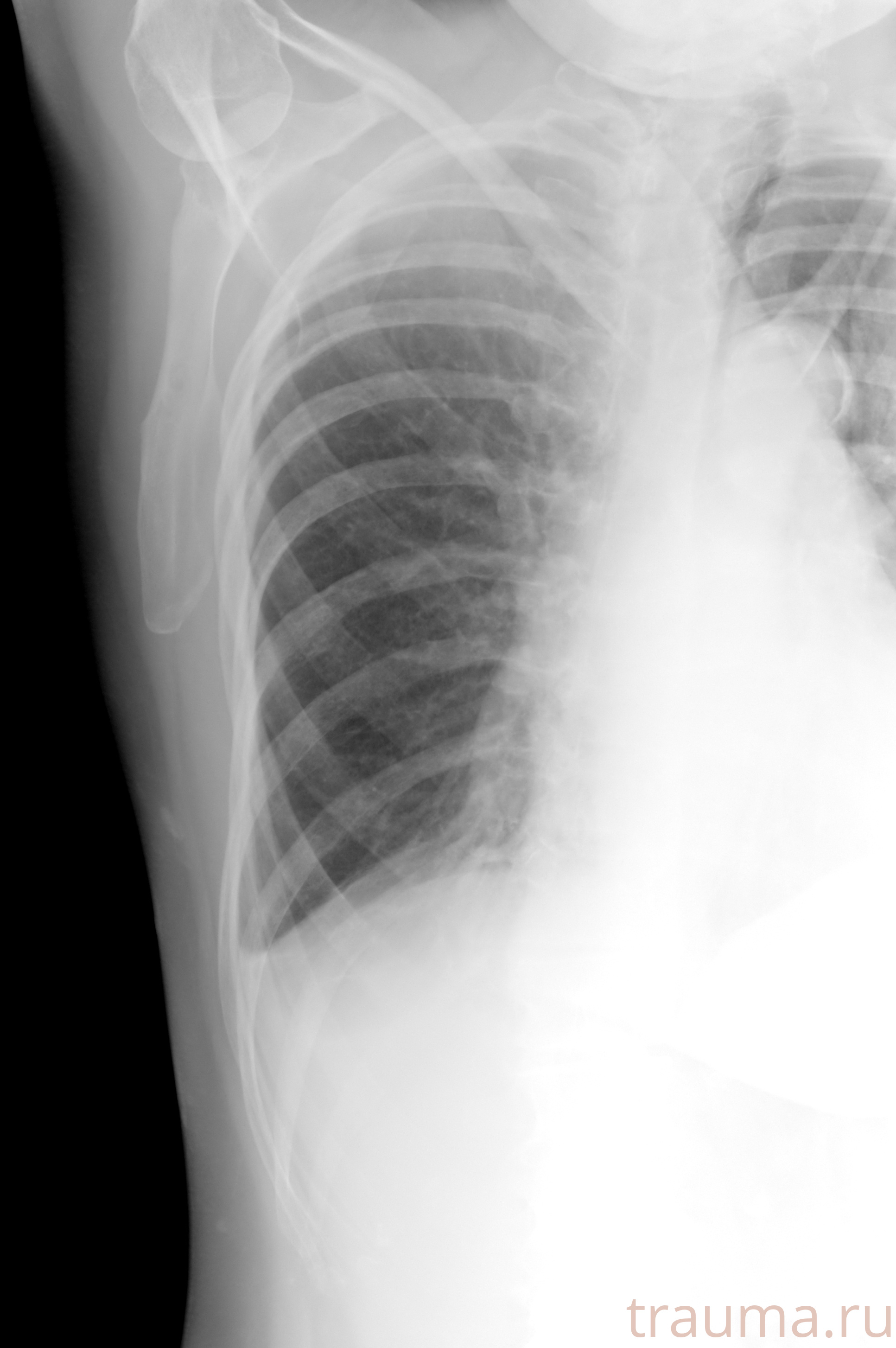 Рентген на дому: по вашему адресу приезжает врач-рентгенолог, травматолог-ортопед с мобильным рентгеновским аппаратом, проводит диагностику травмы или заболевания, делает необходимые рентгенограммы, дает рекомендации по дальнейшему лечению. Получить качественные снимки в домашних условиях возможно благодаря уникальной методике, разработанной МосРентген Центром для института  Склифосовского