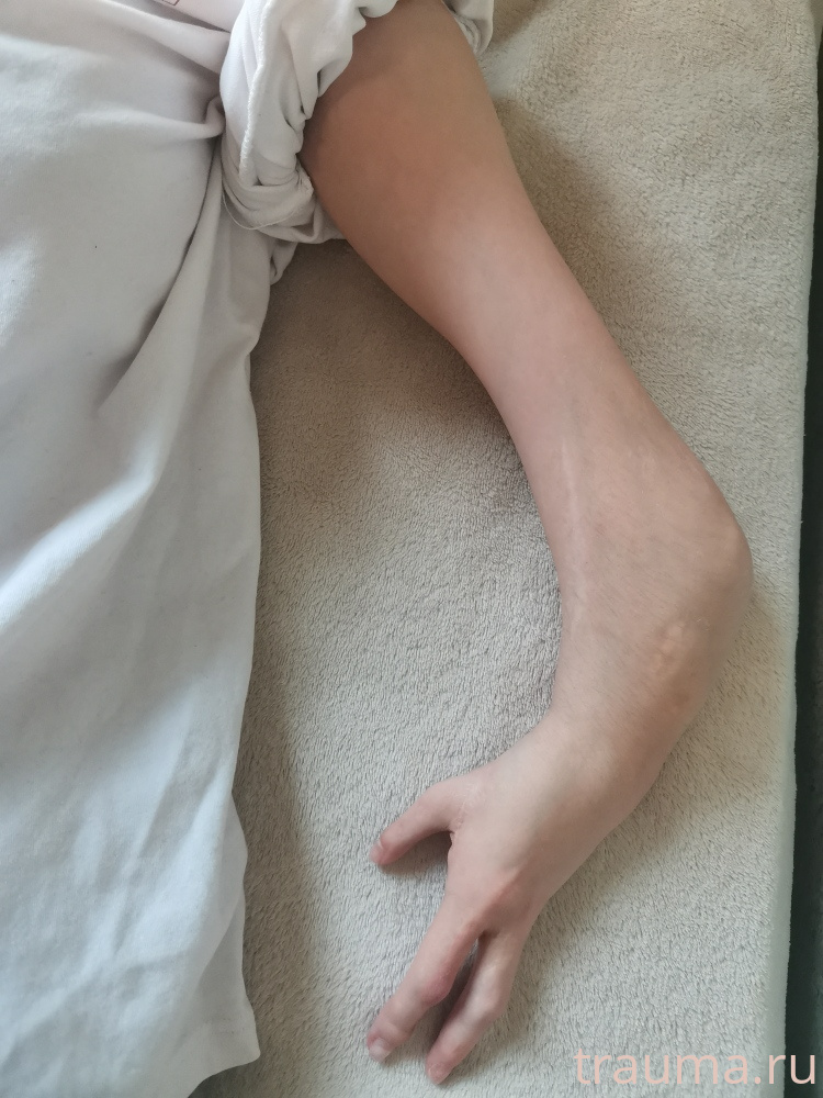 Рентген на дому: по вашему адресу приезжает врач-рентгенолог, травматолог-ортопед с мобильным рентгеновским аппаратом, проводит диагностику травмы или заболевания, делает необходимые рентгенограммы, дает рекомендации по дальнейшему лечению. Получить качественные снимки в домашних условиях возможно благодаря уникальной методике, разработанной МосРентген Центром для института  Склифосовского