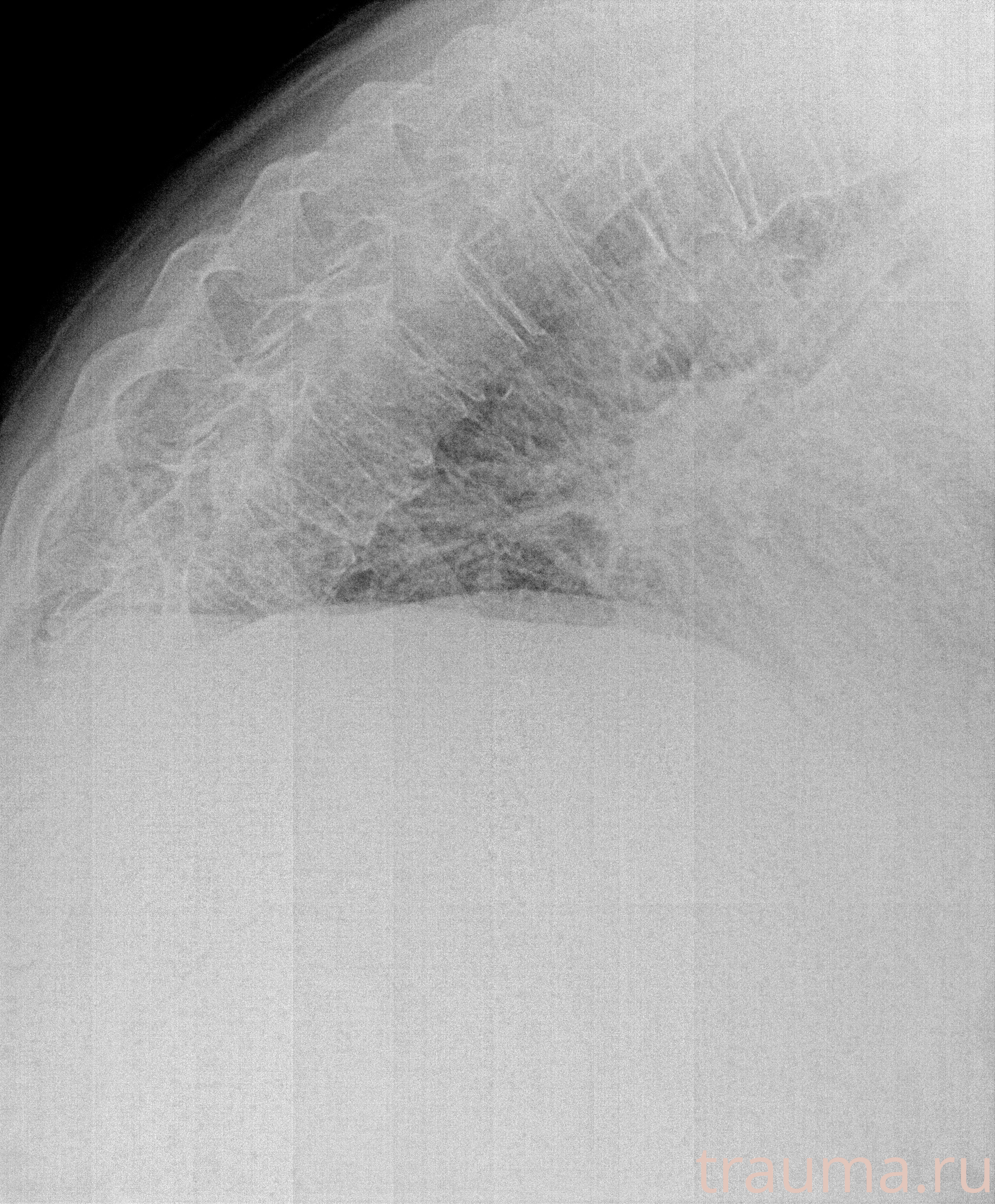 Рентген на дому: по вашему адресу приезжает врач-рентгенолог, травматолог-ортопед с мобильным рентгеновским аппаратом, проводит диагностику травмы или заболевания, делает необходимые рентгенограммы, дает рекомендации по дальнейшему лечению. Получить качественные снимки в домашних условиях возможно благодаря уникальной методике, разработанной МосРентген Центром для института  Склифосовского