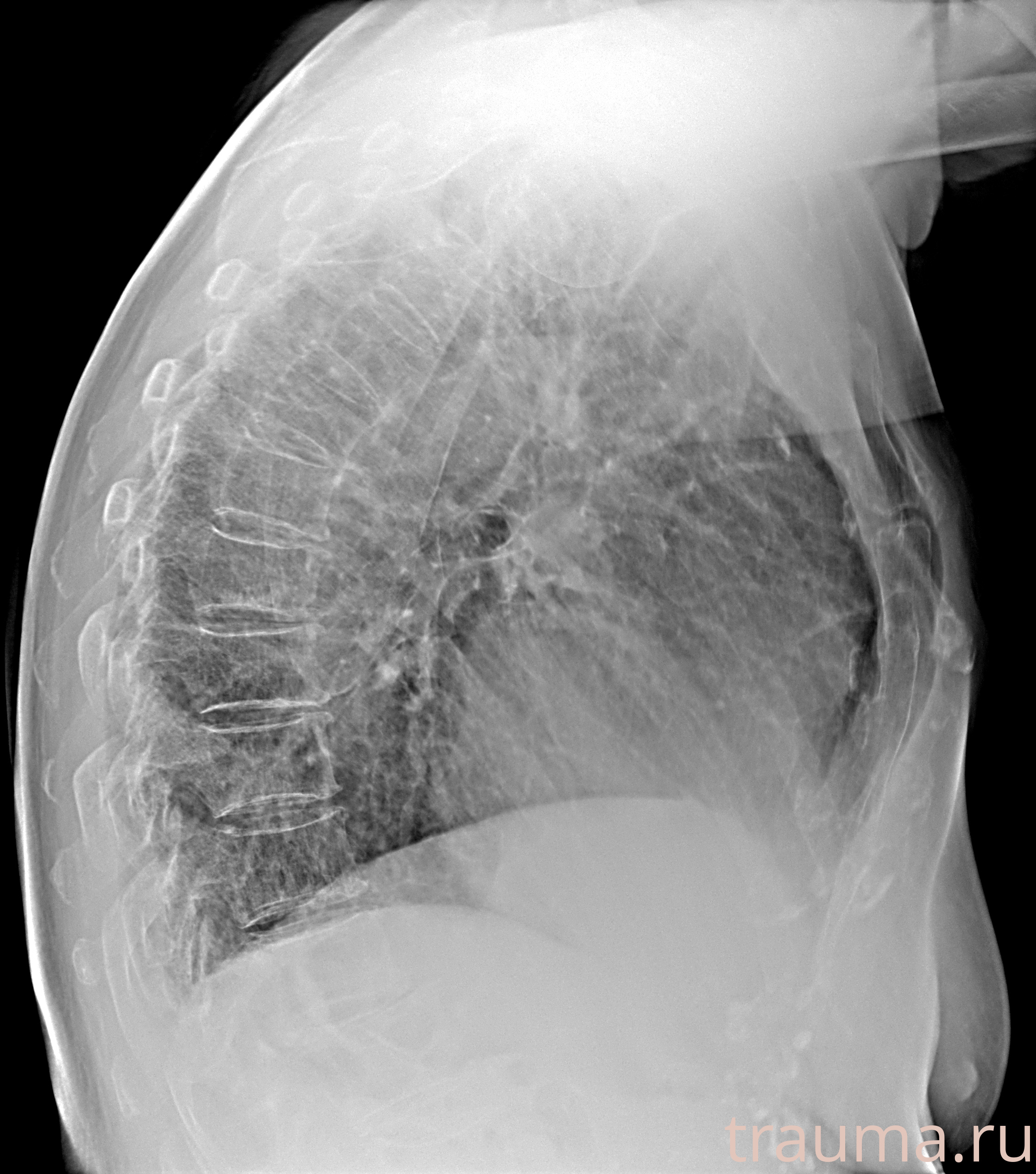 Рентген на дому: по вашему адресу приезжает врач-рентгенолог, травматолог-ортопед с мобильным рентгеновским аппаратом, проводит диагностику травмы или заболевания, делает необходимые рентгенограммы, дает рекомендации по дальнейшему лечению. Получить качественные снимки в домашних условиях возможно благодаря уникальной методике, разработанной МосРентген Центром для института  Склифосовского