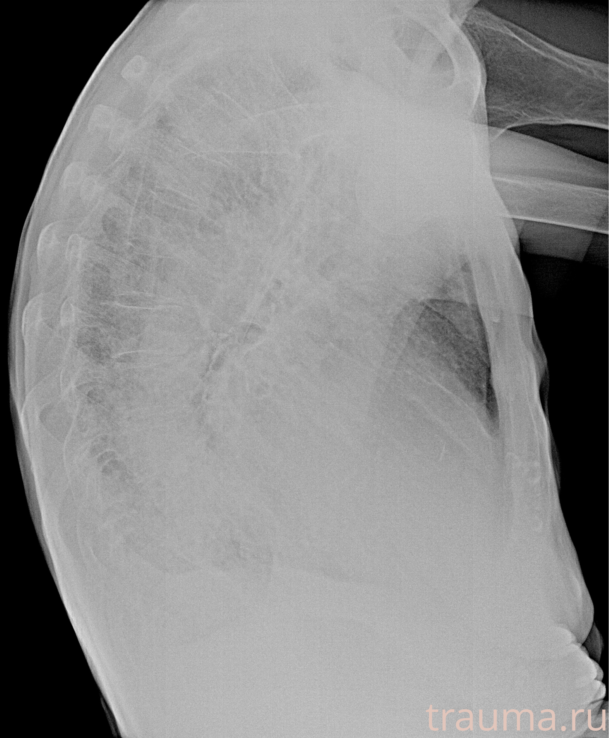 Рентген на дому: по вашему адресу приезжает врач-рентгенолог, травматолог-ортопед с мобильным рентгеновским аппаратом, проводит диагностику травмы или заболевания, делает необходимые рентгенограммы, дает рекомендации по дальнейшему лечению. Получить качественные снимки в домашних условиях возможно благодаря уникальной методике, разработанной МосРентген Центром для института  Склифосовского