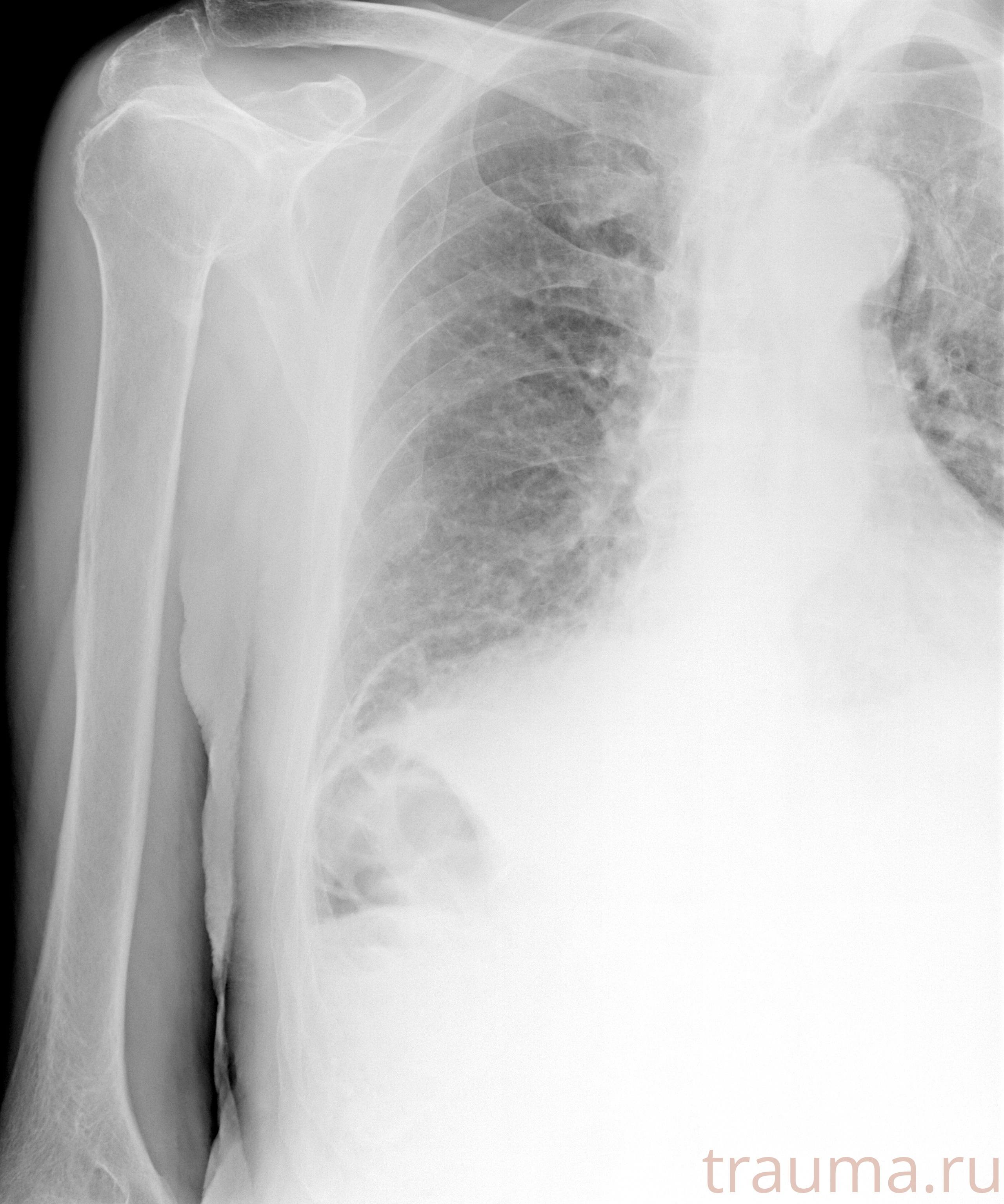 Рентген на дому: по вашему адресу приезжает врач-рентгенолог, травматолог-ортопед с мобильным рентгеновским аппаратом, проводит диагностику травмы или заболевания, делает необходимые рентгенограммы, дает рекомендации по дальнейшему лечению. Получить качественные снимки в домашних условиях возможно благодаря уникальной методике, разработанной МосРентген Центром для института  Склифосовского