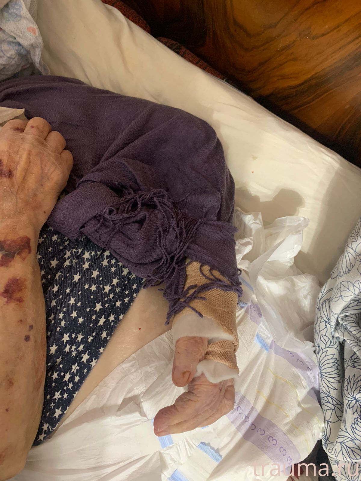 Рентген на дому: по вашему адресу приезжает врач-рентгенолог, травматолог-ортопед с мобильным рентгеновским аппаратом, проводит диагностику травмы или заболевания, делает необходимые рентгенограммы, дает рекомендации по дальнейшему лечению. Получить качественные снимки в домашних условиях возможно благодаря уникальной методике, разработанной МосРентген Центром для института  Склифосовского