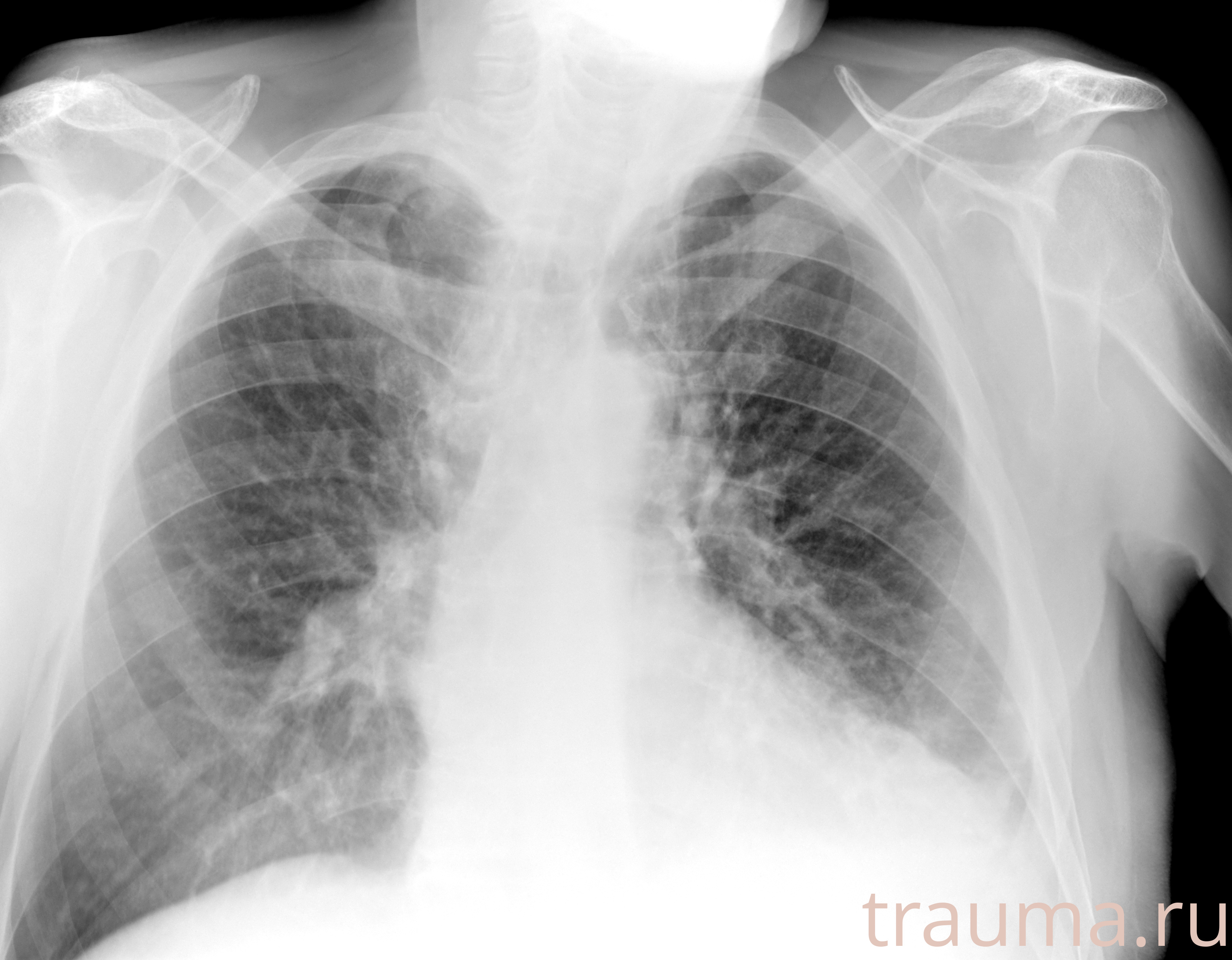 Рентген на дому: по вашему адресу приезжает врач-рентгенолог, травматолог-ортопед с мобильным рентгеновским аппаратом, проводит диагностику травмы или заболевания, делает необходимые рентгенограммы, дает рекомендации по дальнейшему лечению. Получить качественные снимки в домашних условиях возможно благодаря уникальной методике, разработанной МосРентген Центром для института  Склифосовского