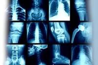 Открытие экрана Radiography Condition Setting(Настройка параметров рентгенографии) Открытие экрана Radiography Condition Setting(Настройка параметров рентгенографии)