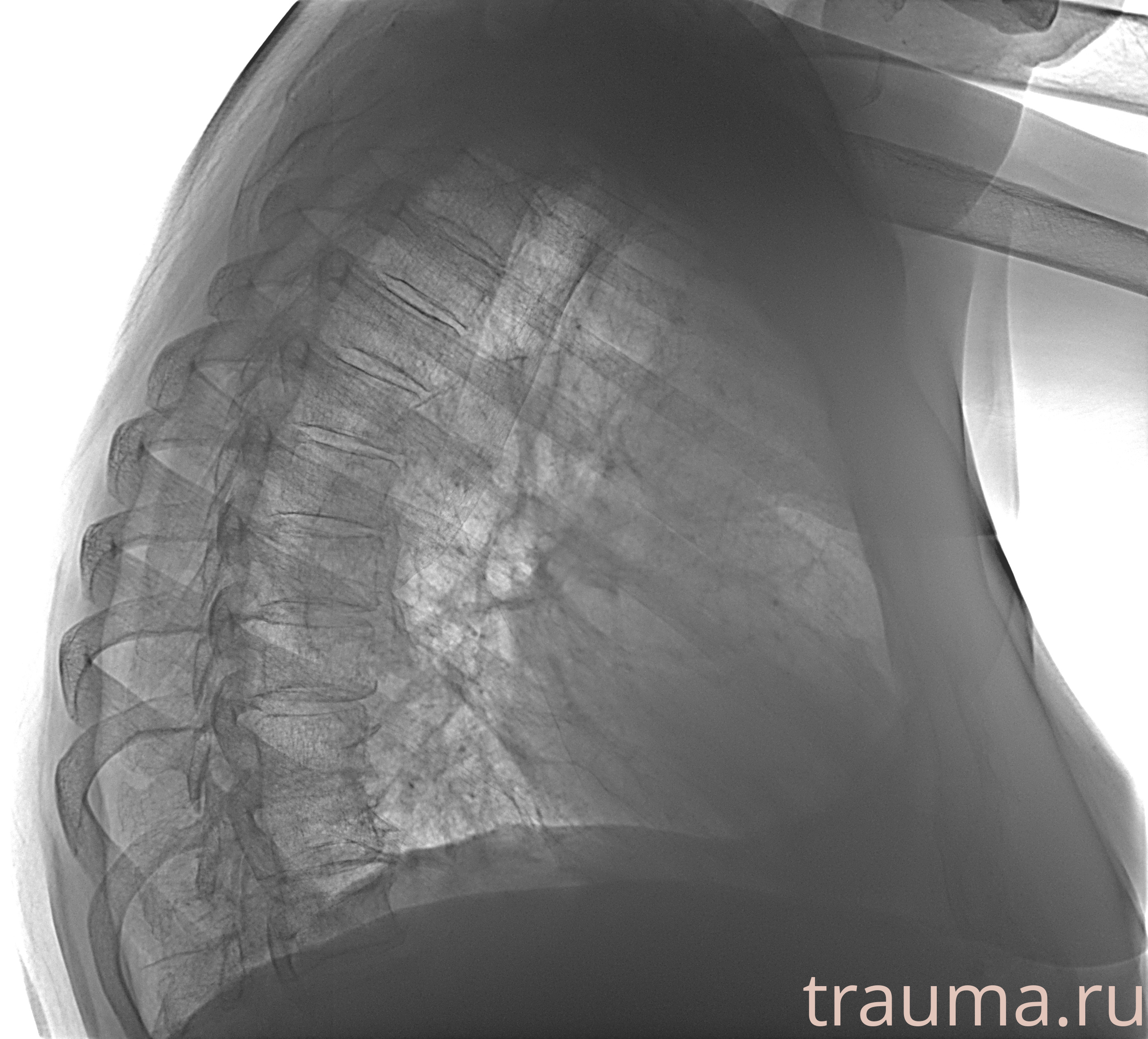 Рентген на дому: по вашему адресу приезжает врач-рентгенолог, травматолог-ортопед с мобильным рентгеновским аппаратом, проводит диагностику травмы или заболевания, делает необходимые рентгенограммы, дает рекомендации по дальнейшему лечению. Получить качественные снимки в домашних условиях возможно благодаря уникальной методике, разработанной МосРентген Центром для института  Склифосовского