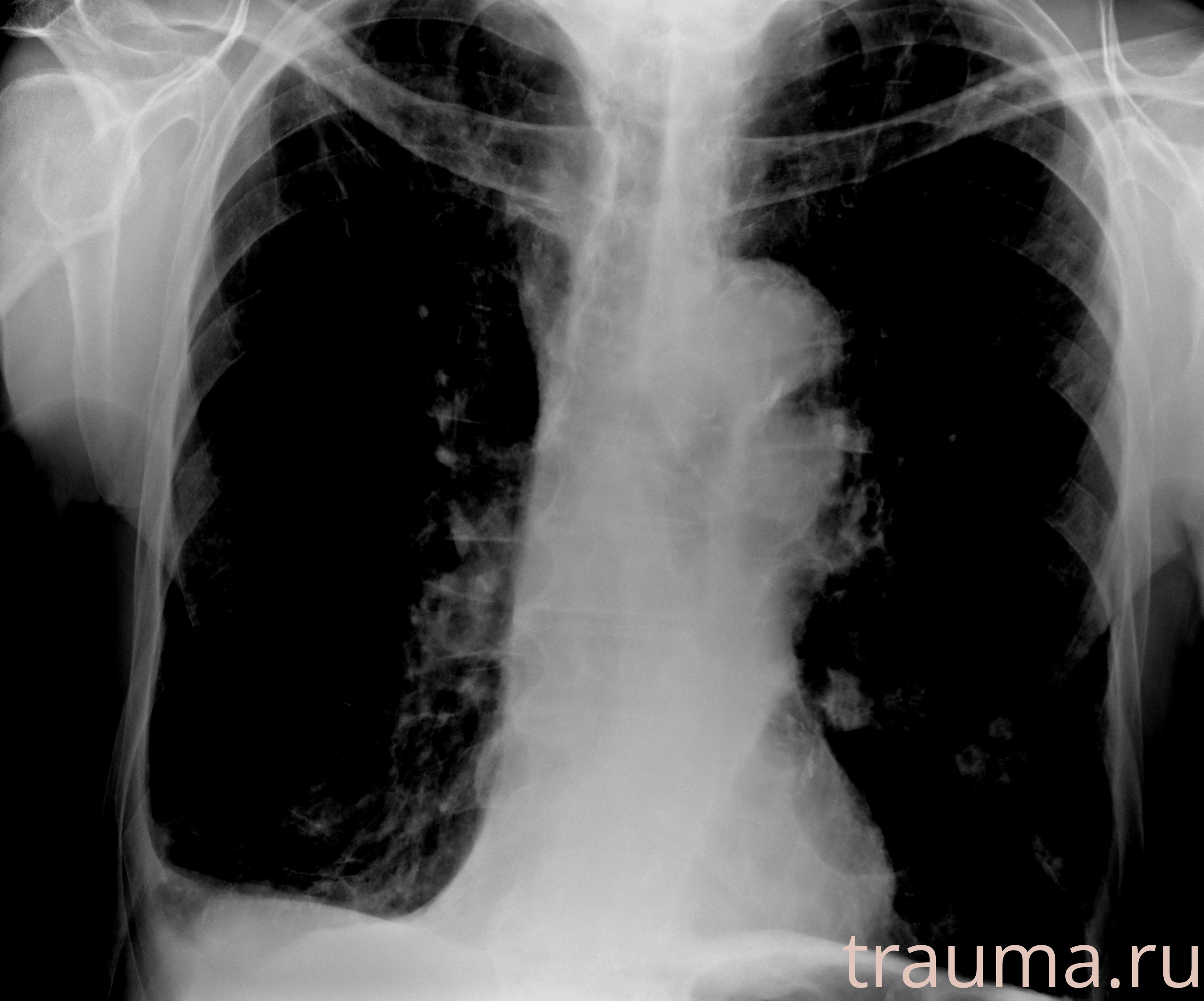 Рентген на дому: по вашему адресу приезжает врач-рентгенолог, травматолог-ортопед с мобильным рентгеновским аппаратом, проводит диагностику травмы или заболевания, делает необходимые рентгенограммы, дает рекомендации по дальнейшему лечению. Получить качественные снимки в домашних условиях возможно благодаря уникальной методике, разработанной МосРентген Центром для института  Склифосовского